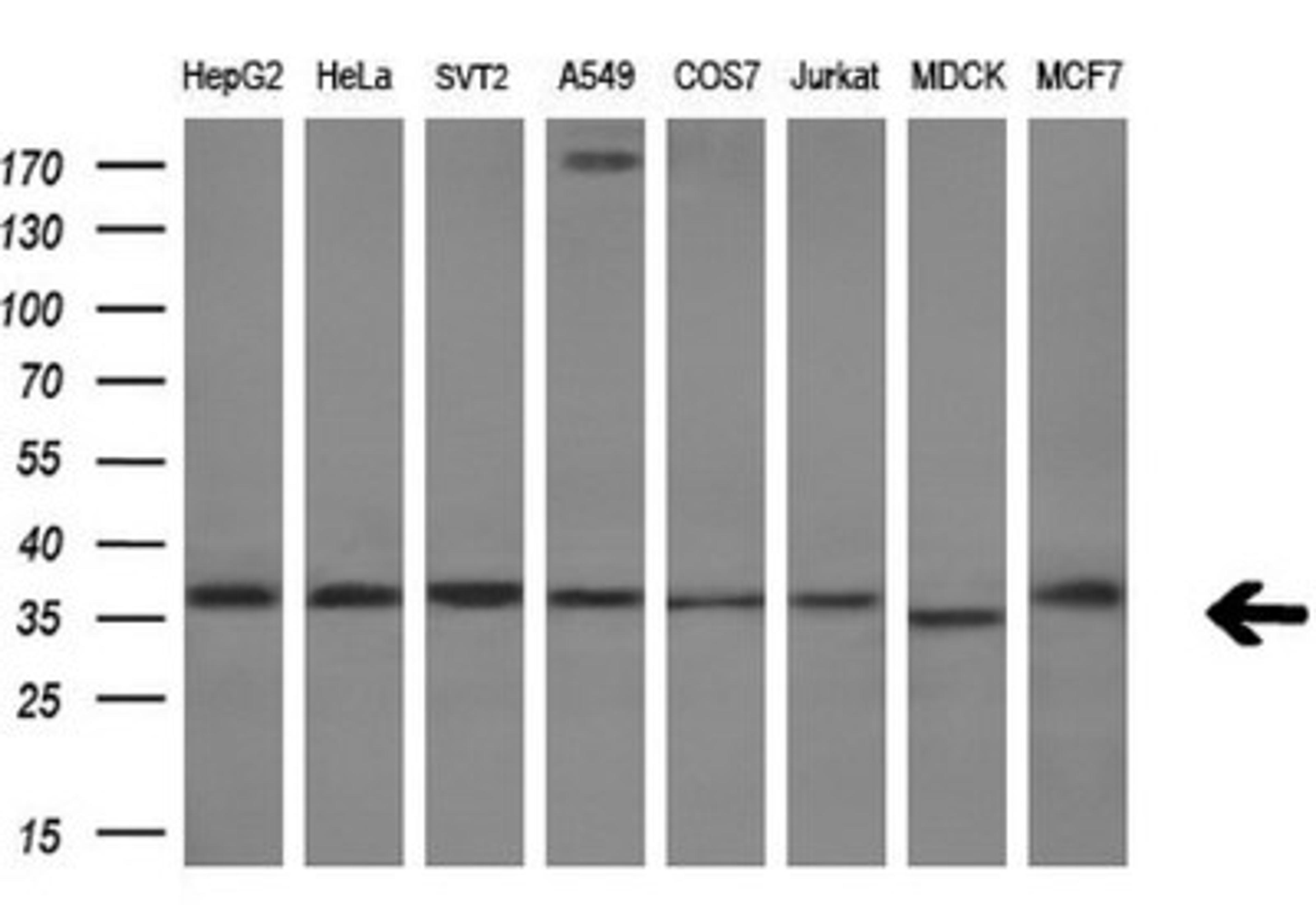 Western Blot: RARRES1 Antibody (1D2) [NBP2-45517] - Analysis of extracts (10ug) from 8 different cell lines by using RARRES1 monoclonal antibody.