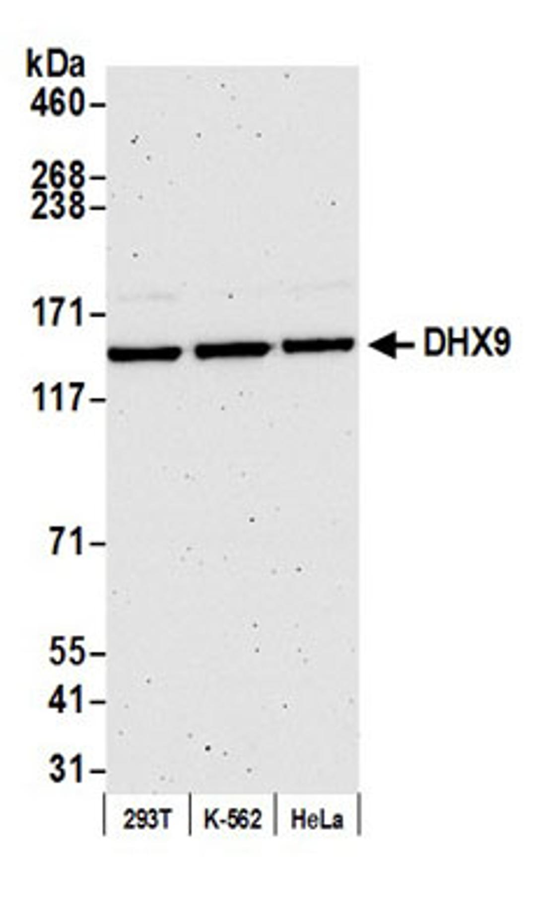 Detection of human DHX9 by western blot.