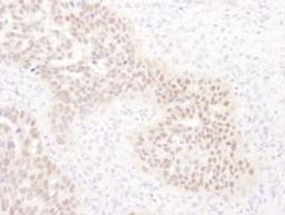 Detection of human WRNIP1 by immunohistochemistry.