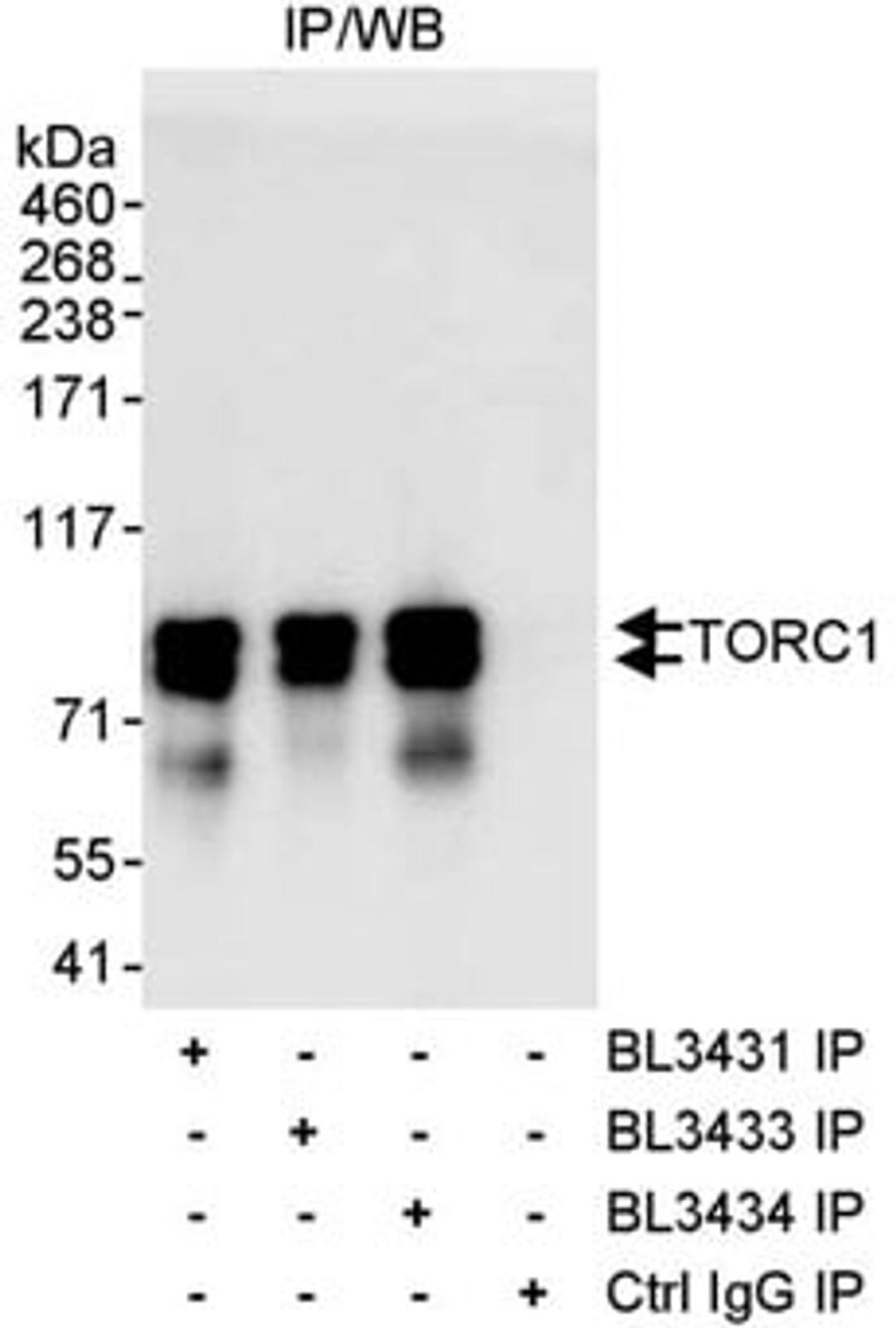 Detection of human TORC1 by western blot of immunoprecipitates.