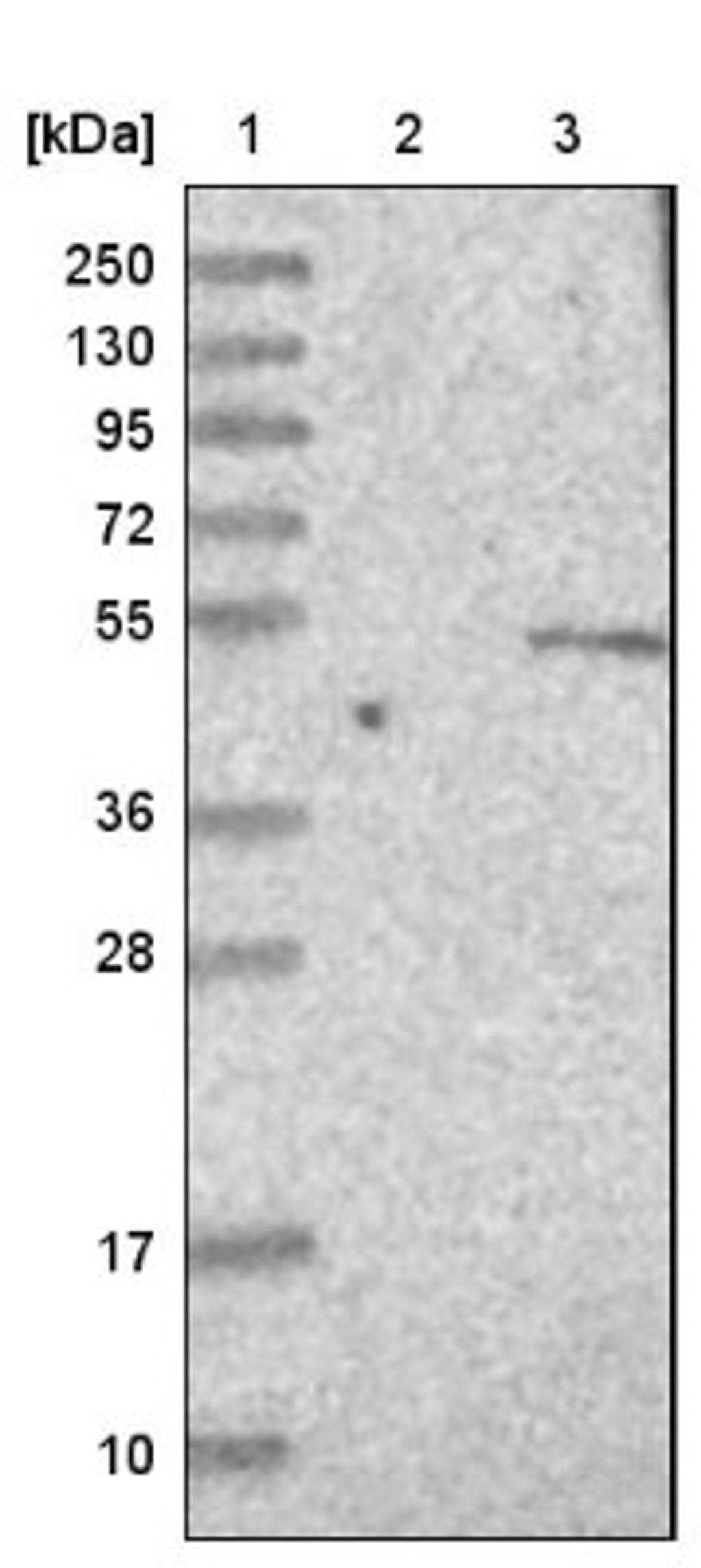 Western Blot: STK40 Antibody [NBP1-82678] - Lane 1: Marker [kDa] 250, 130, 95, 72, 55, 36, 28, 17, 10<br/>Lane 2: Negative control (vector only transfected HEK293T lysate)<br/>Lane 3: Over-expression lysate (Co-expressed with a C-terminal myc-DDK tag (~3.1 kDa) in mammalian HEK293T cells, LY403137)