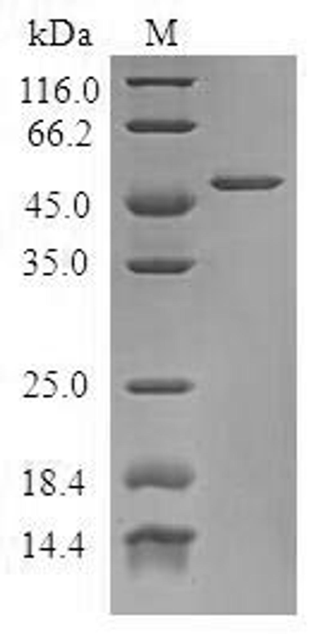 (Tris-Glycine gel) Discontinuous SDS-PAGE (reduced) with 5% enrichment gel and 15% separation gel.