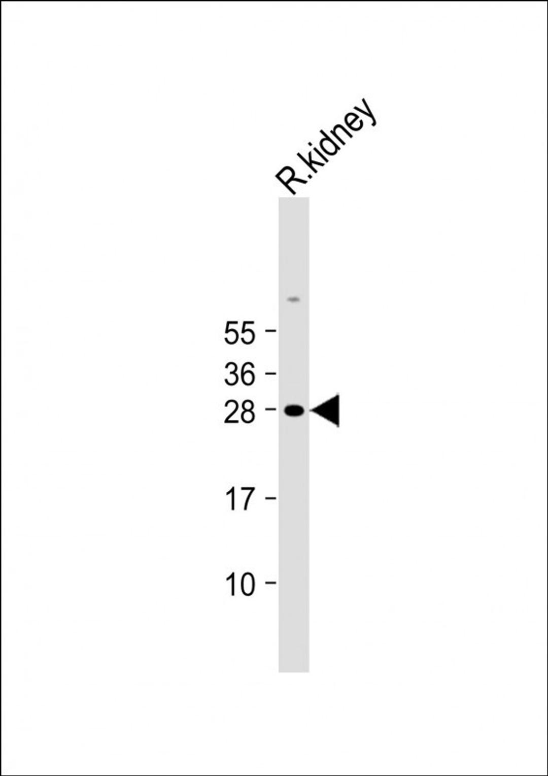 Western Blot at 1:2000 dilution + Rat kidney lysate Lysates/proteins at 20 ug per lane.