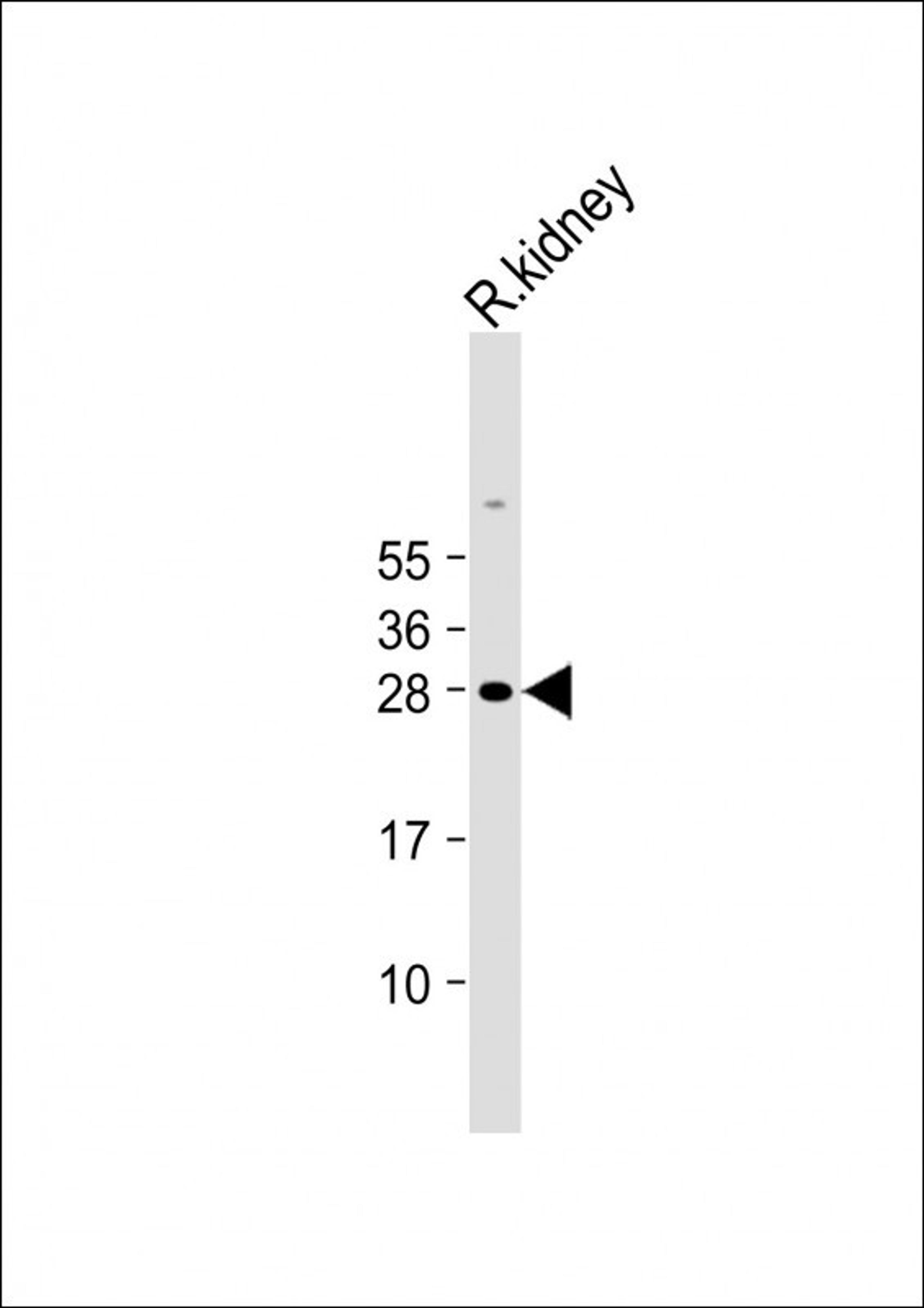 Western Blot at 1:2000 dilution + Rat kidney lysate Lysates/proteins at 20 ug per lane.