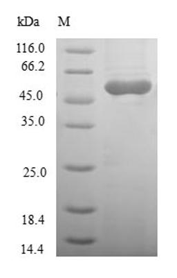 (Tris-Glycine gel) Discontinuous SDS-PAGE (reduced) with 5% enrichment gel and 15% separation gel.