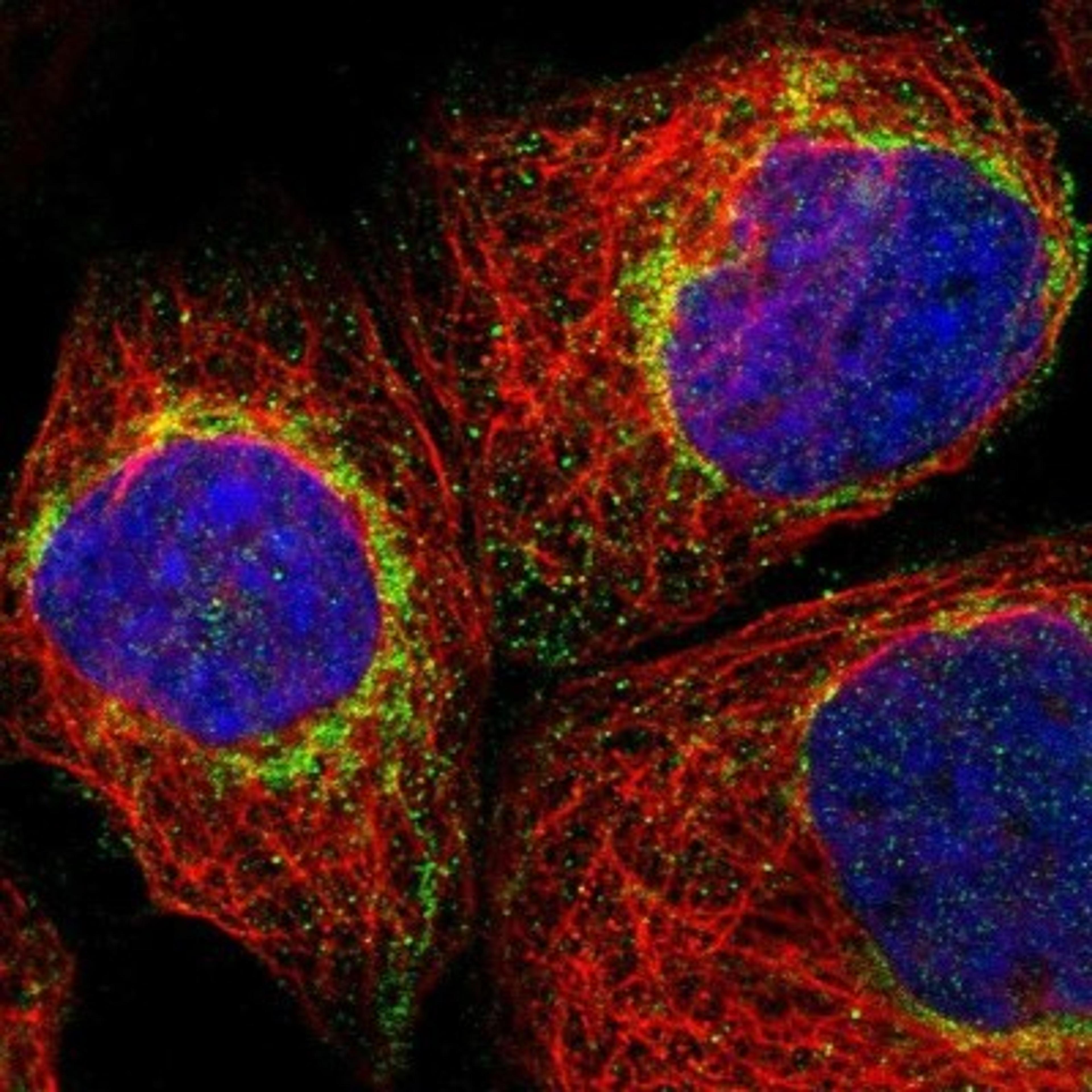 Immunocytochemistry/Immunofluorescence: Mitochondrial fission regulator 1 Antibody [NBP1-84480] - Staining of human cell line A-431 shows positivity in mitochondria.