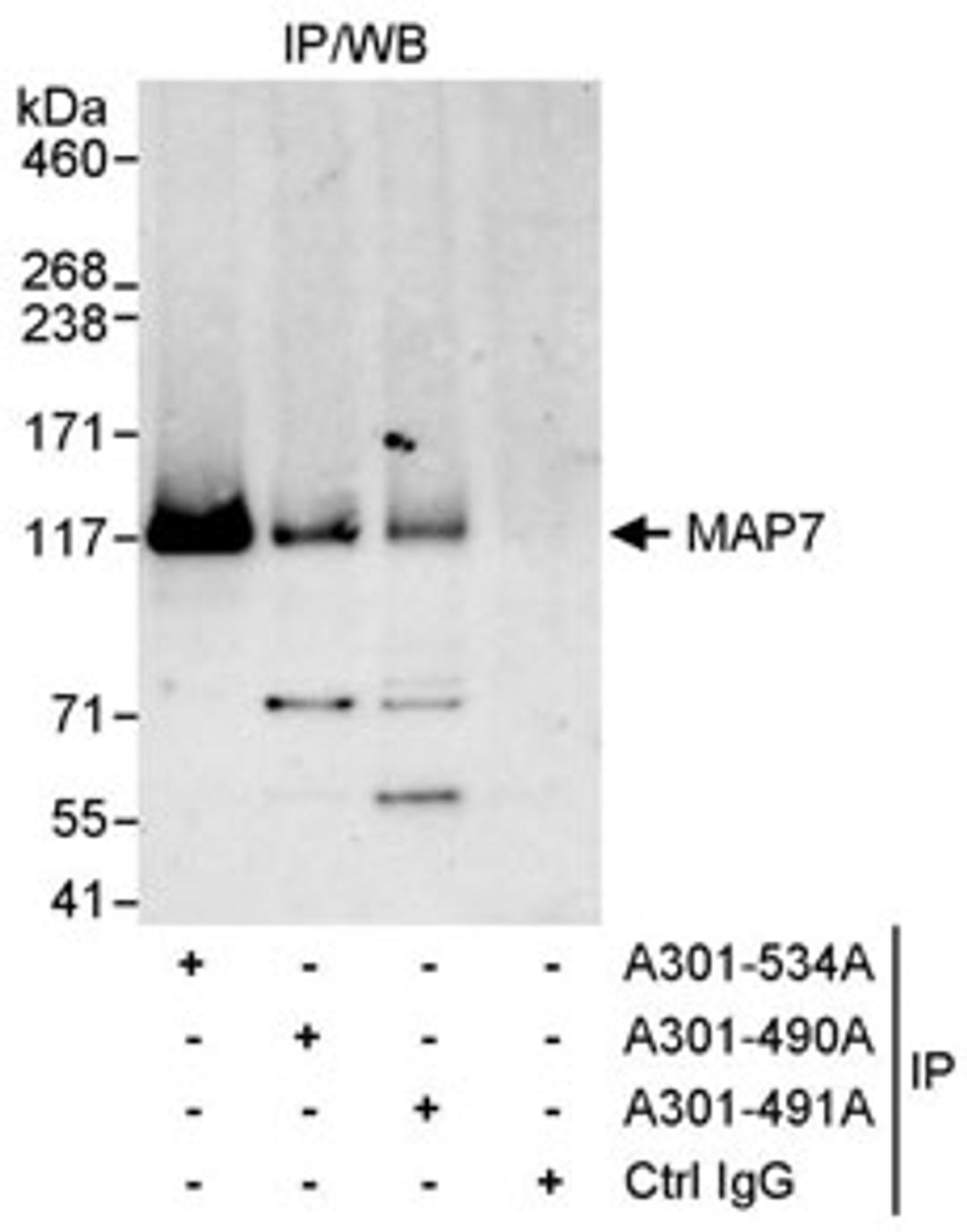 Detection of human MAP7 by western blot of immunoprecipitates.