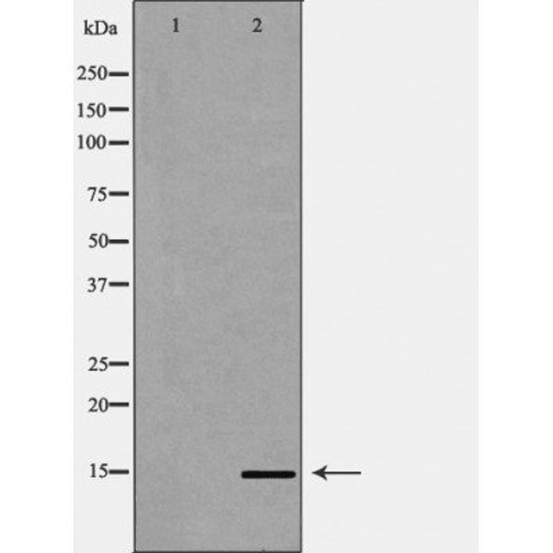 Western blot analysis of HeLa cell line and H3 protein expressed in E.coli using Histone H3K79me3 antibody