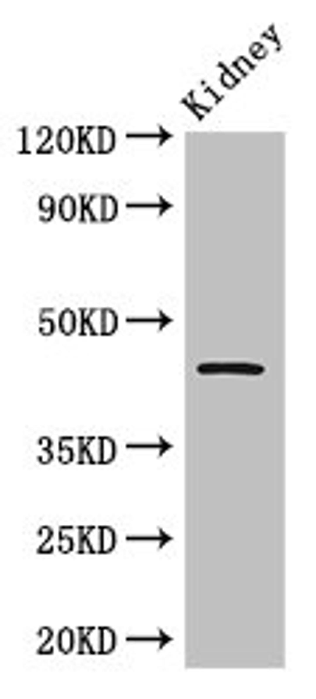 Western Blot. Positive WB detected in: Mouse kidney tissue. All lanes: Tp53 antibody at 2.5µg/ml. Secondary. Goat polyclonal to rabbit IgG at 1/50000 dilution. Predicted band size: 44 kDa. Observed band size: 44 kDa