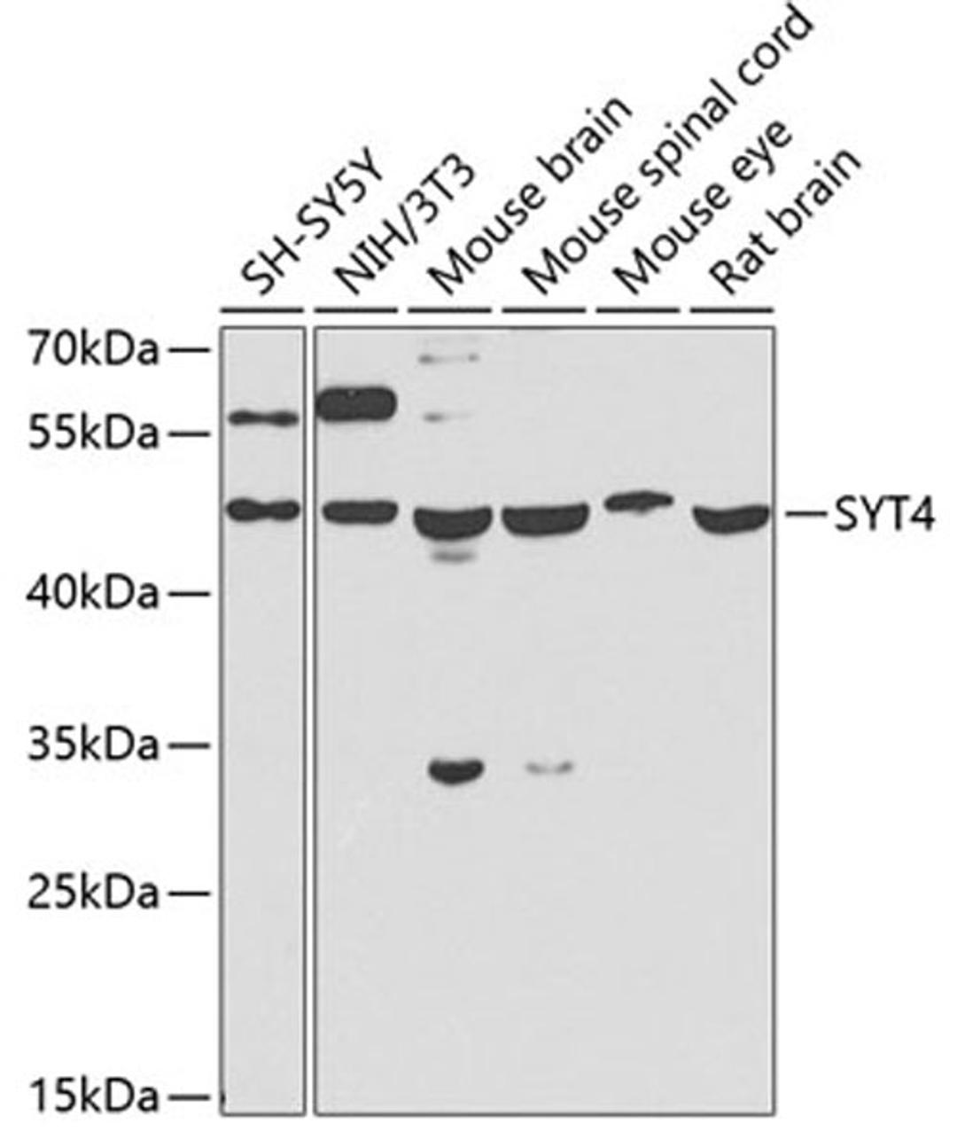 Western blot - SYT4 antibody (A7737)