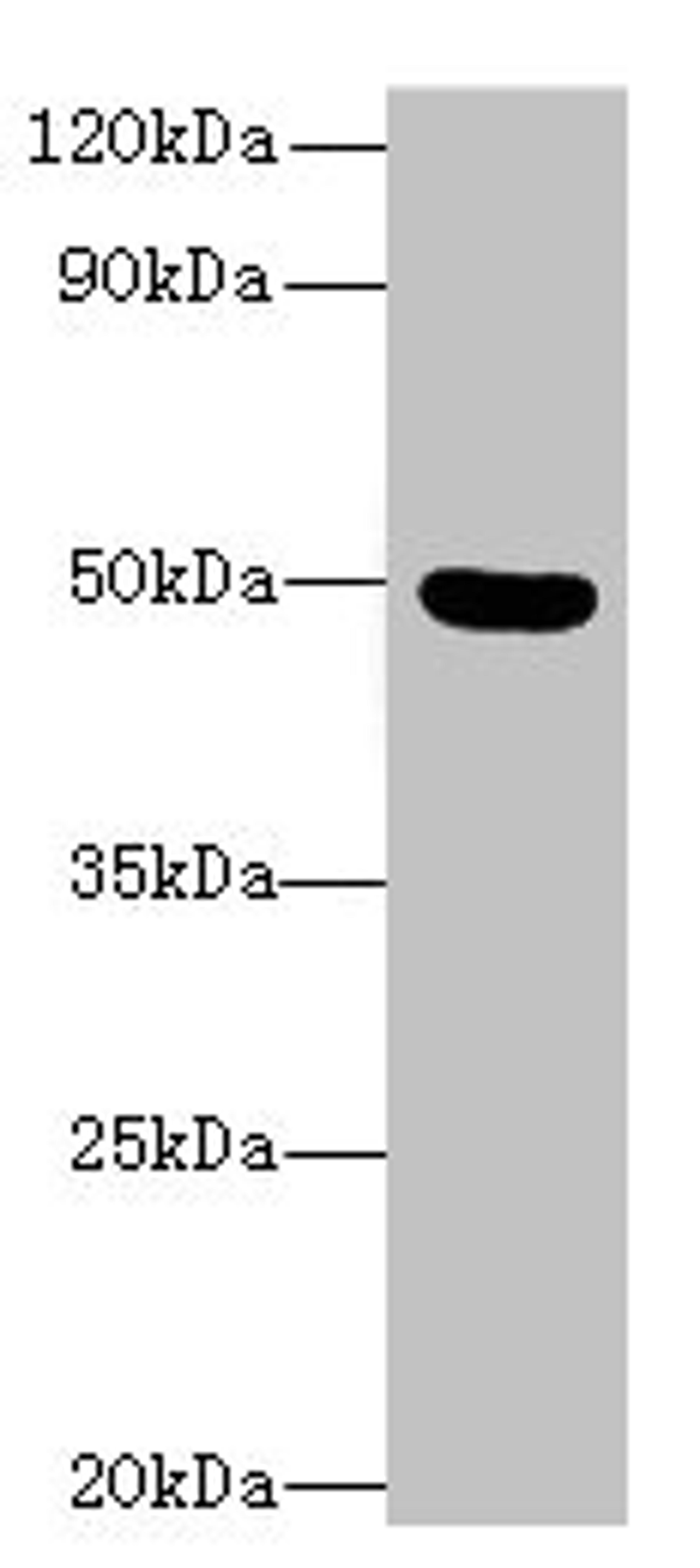 Western blot. All lanes: C5orf22 antibody at 8µg/ml + Mouse brain tissue. Secondary. Goat polyclonal to rabbit IgG at 1/10000 dilution. Predicted band size: 50, 21, 19 kDa. Observed band size: 50 kDa