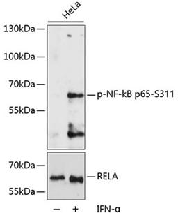 Western blot - Phospho-NF-kB p65-S311 antibody (AP0445)