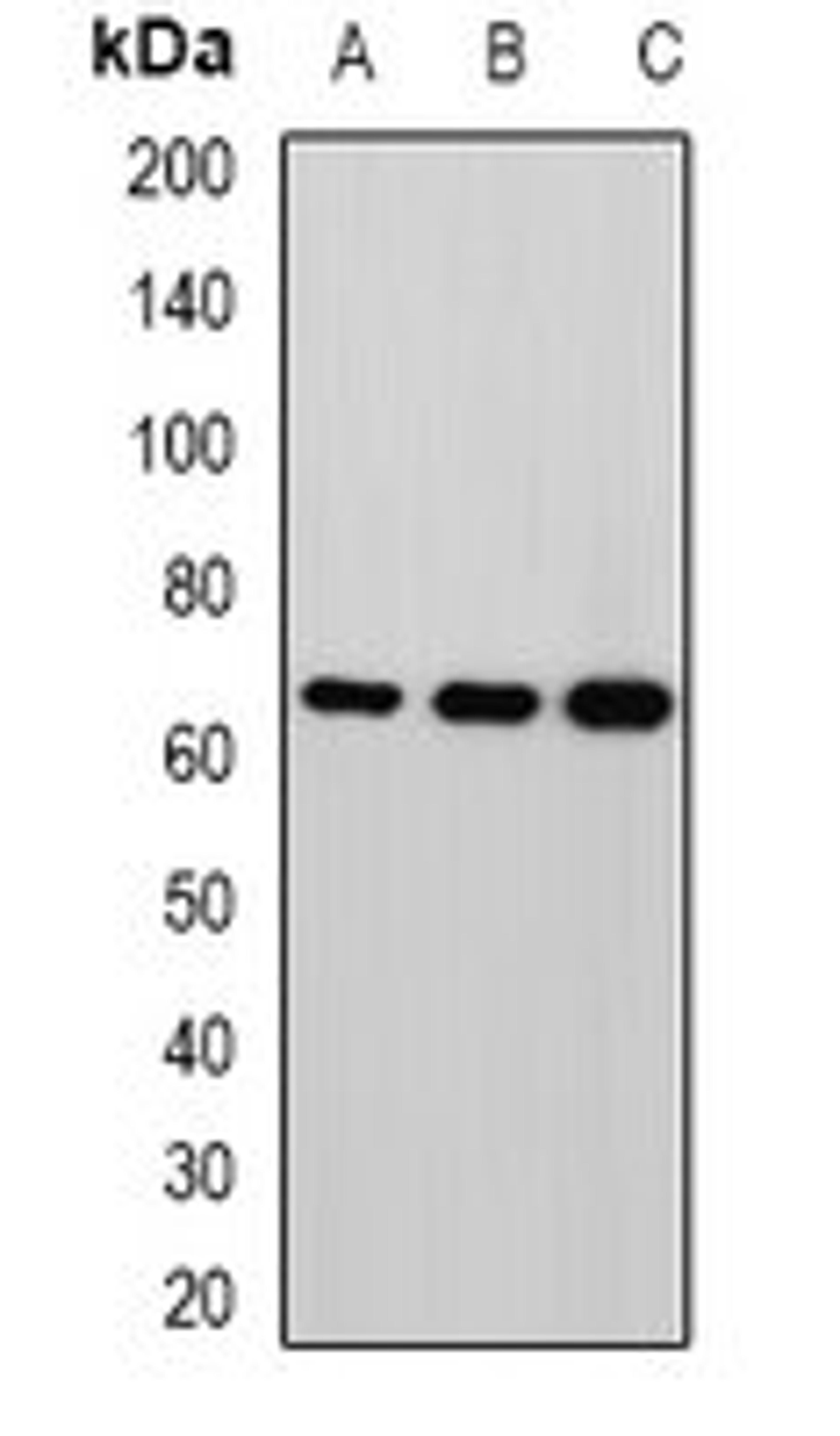 Western blot analysis of HepG2 (Lane1), mouse brain (Lane2), rat brain (Lane3) whole cell lysates using MPP2 antibody