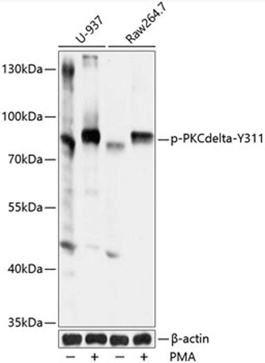 Western blot - Phospho-PKCdelta-Y311 antibody (AP0496)