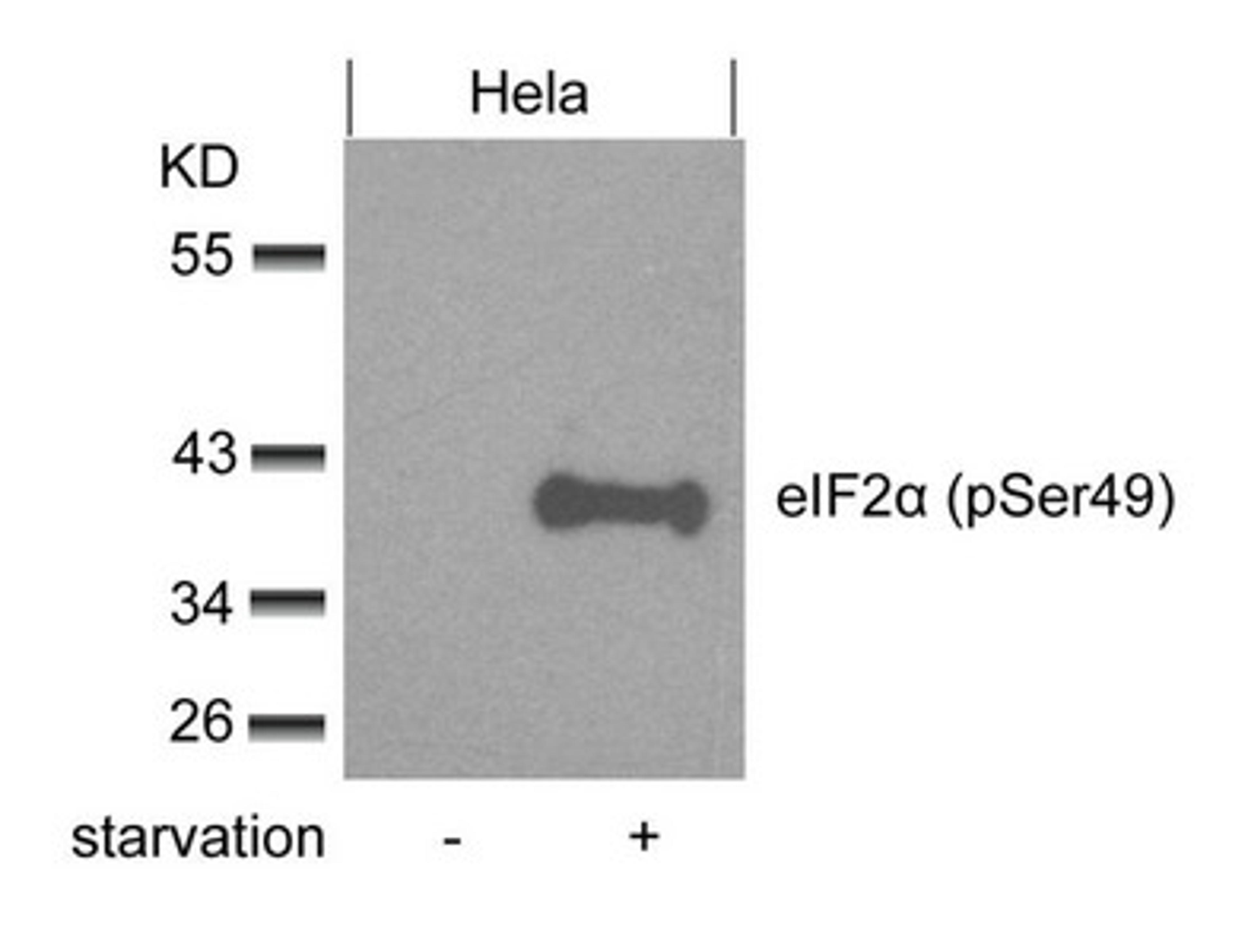 Western blot analysis of extracts from Hela cells untreated or treated with starvation using eIF2a(phospho-Ser49) Antibody.