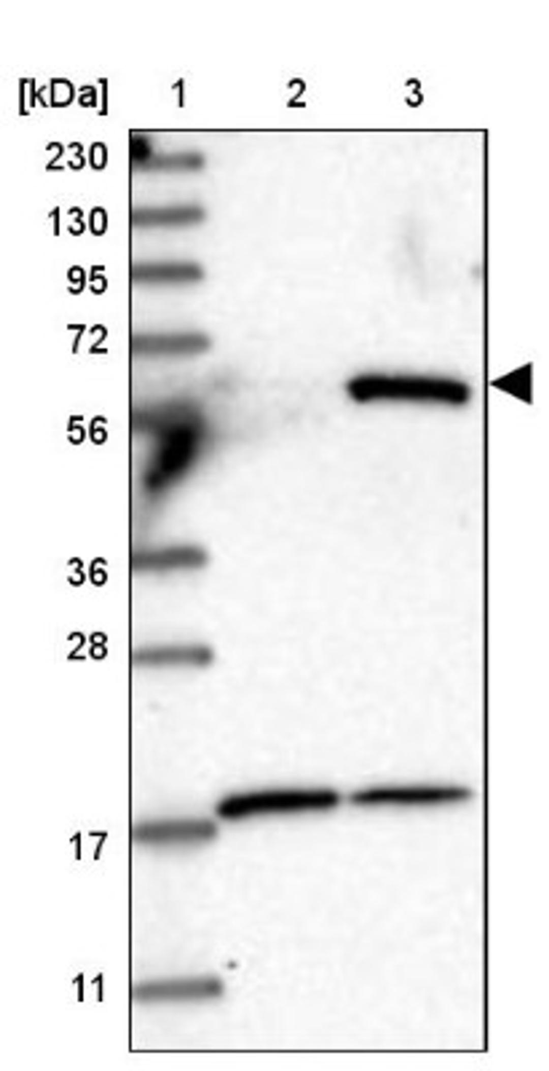 Western Blot: PYROXD2 Antibody [NBP2-32688] - Lane 1: Marker [kDa] 230, 130, 95, 72, 56, 36, 28, 17, 11<br/>Lane 2: Human cell line RT-4<br/>Lane 3: Human cell line U-251MG sp