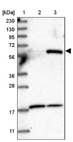 Western Blot: PYROXD2 Antibody [NBP2-32688] - Lane 1: Marker [kDa] 230, 130, 95, 72, 56, 36, 28, 17, 11<br/>Lane 2: Human cell line RT-4<br/>Lane 3: Human cell line U-251MG sp