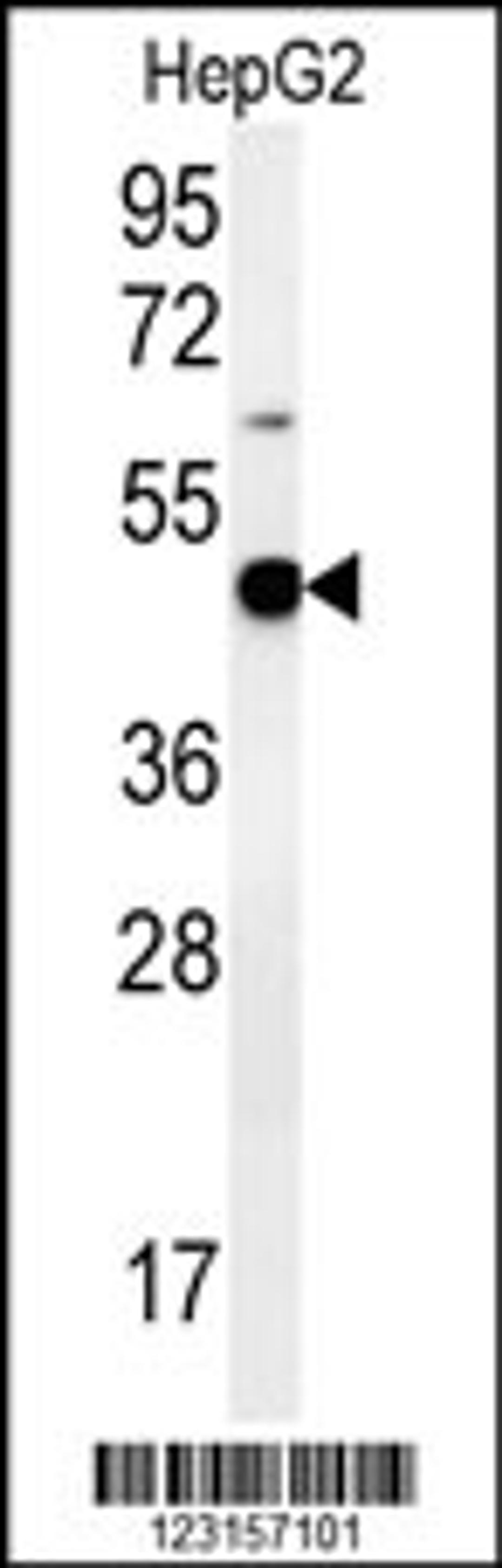 Western blot analysis in HepG2 cell line lysates (35ug/lane).