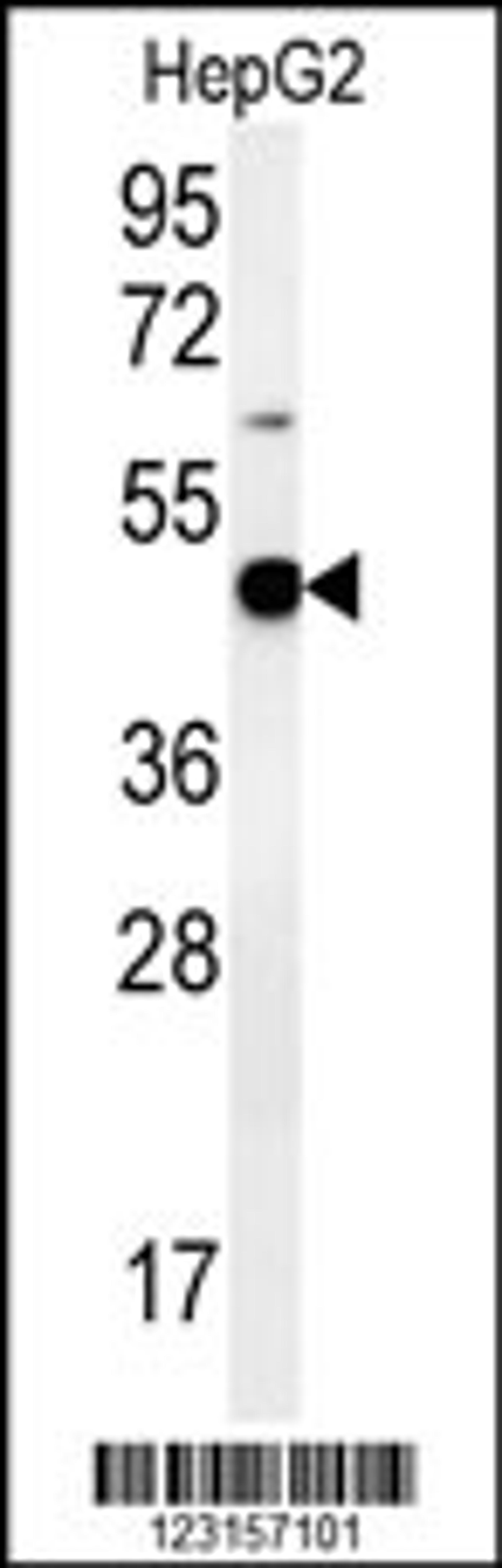Western blot analysis in HepG2 cell line lysates (35ug/lane).