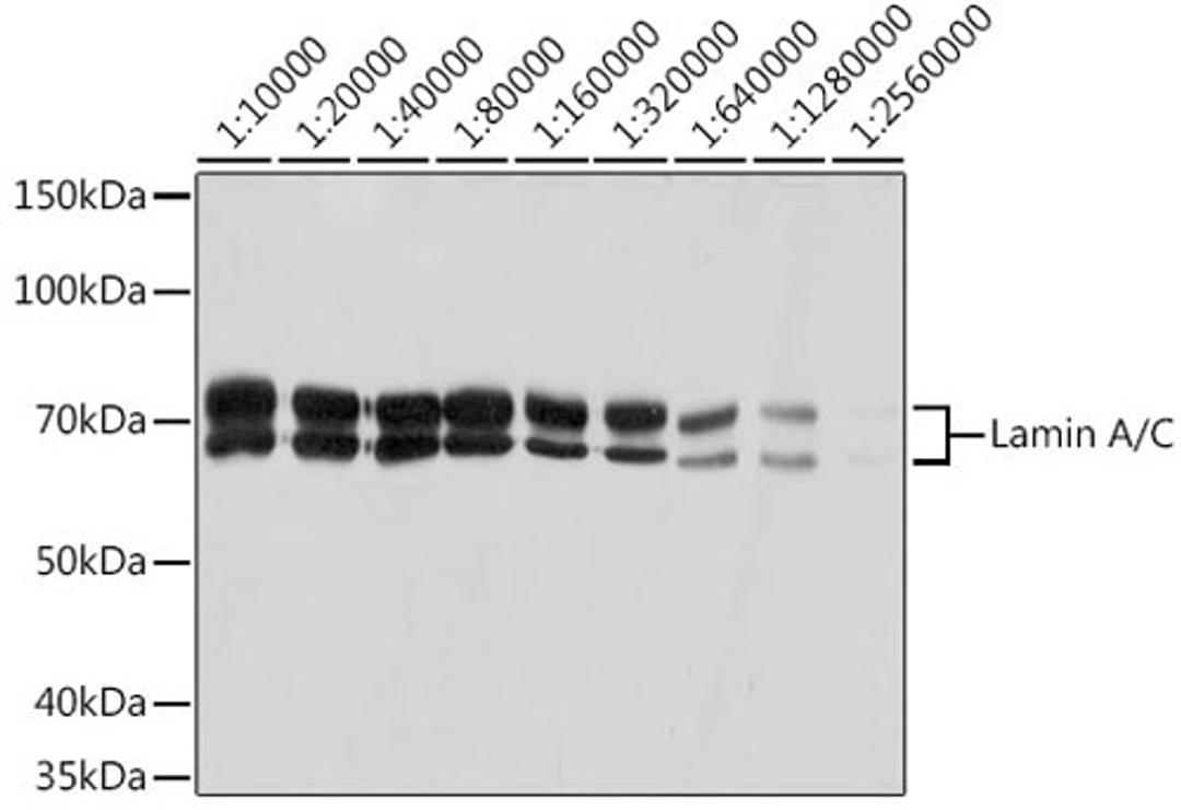 Western blot - Lamin A/C antibody (A19524)