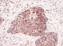 Detection of human C1QBP by immunohistochemistry.