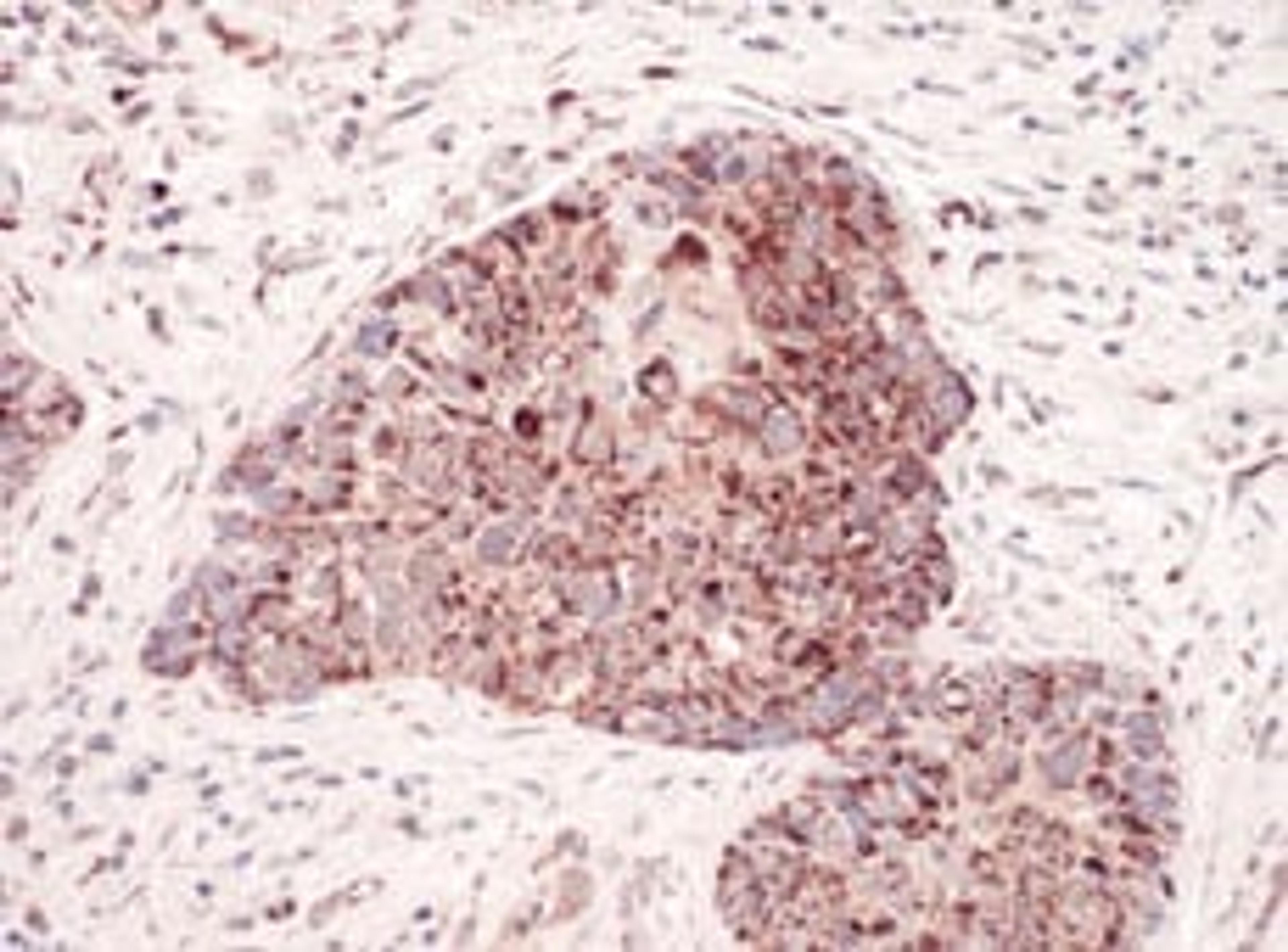 Detection of human C1QBP by immunohistochemistry.