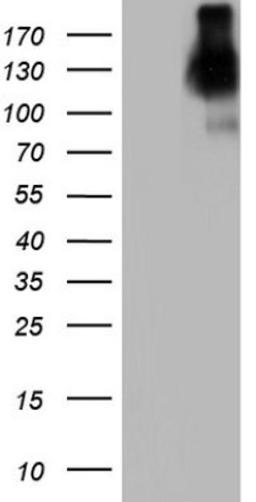 Western Blot: CEACAM-5/CD66e Antibody (3D8) [NBP2-46231] - Analysis of HEK293T cells were transfected with the pCMV6-ENTRY control (Left lane) or pCMV6-ENTRY CEACAM-5.