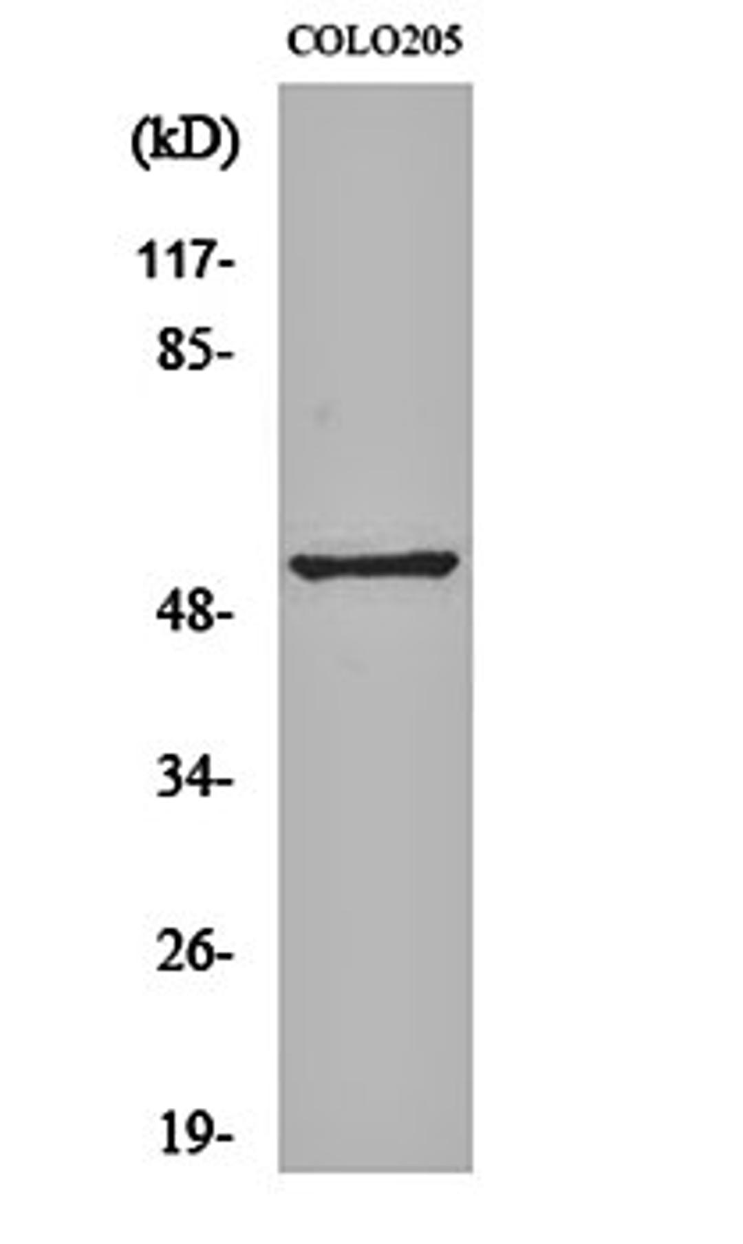 Western blot analysis of COLO205 cell lysates using Melanopsin antibody