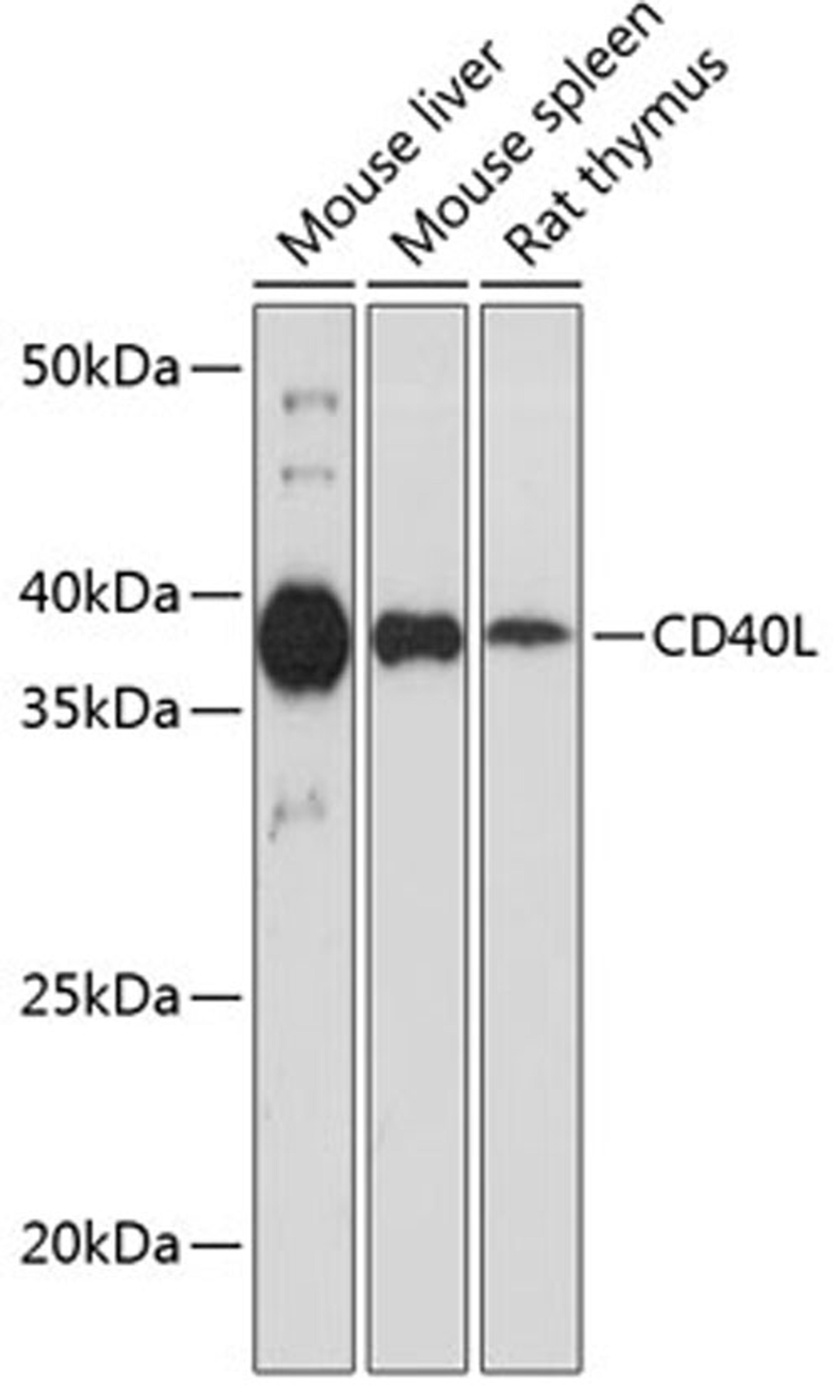 Western blot - CD40L antibody (A19019)