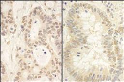 Detection of human FAF1 by immunohistochemistry.