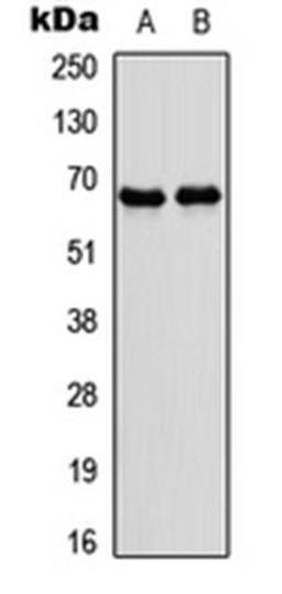 Western blot analysis of IMR32 (Lane1), rat skeletal muscle (Lane2) whole cell using NR4A3 antibody