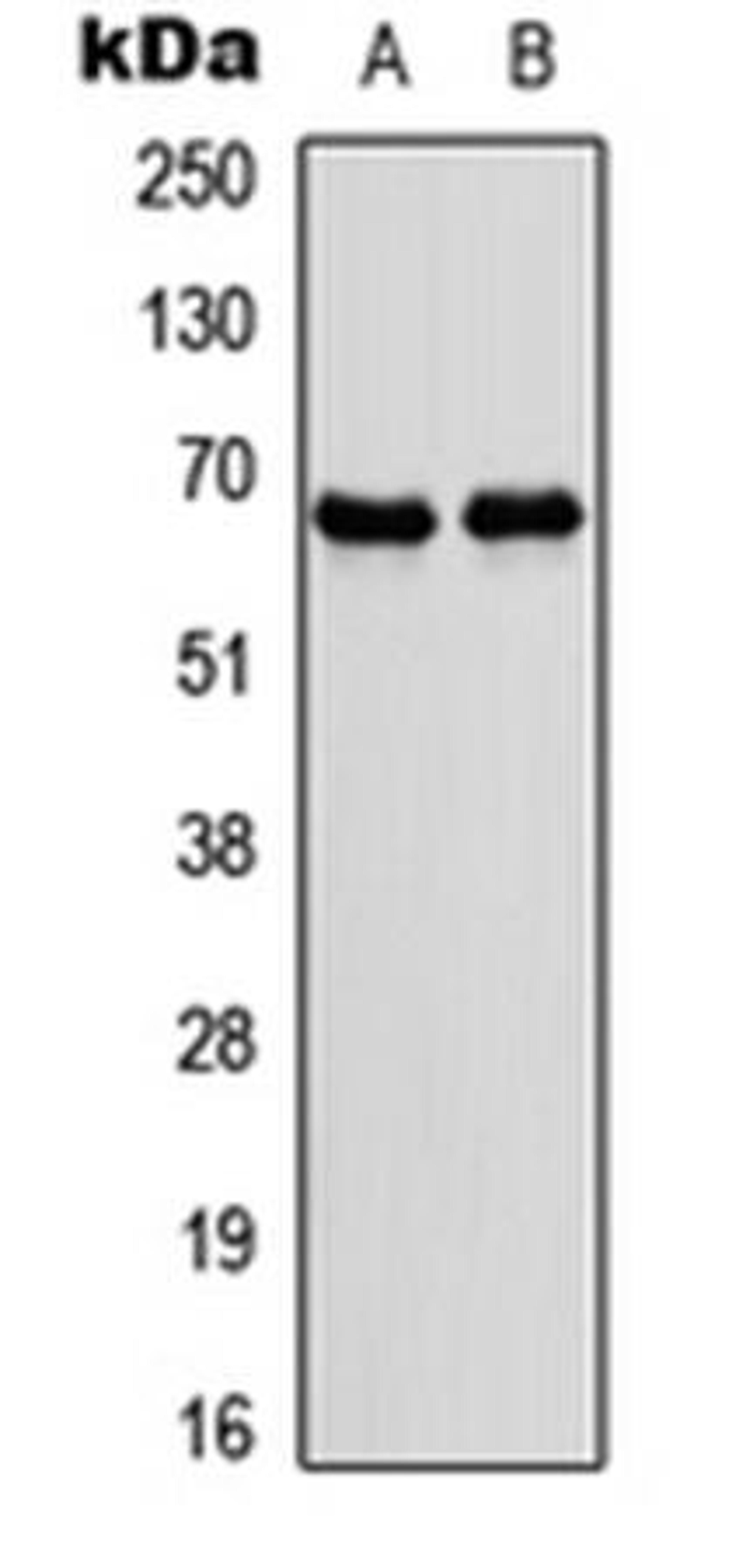 Western blot analysis of IMR32 (Lane1), rat skeletal muscle (Lane2) whole cell using NR4A3 antibody