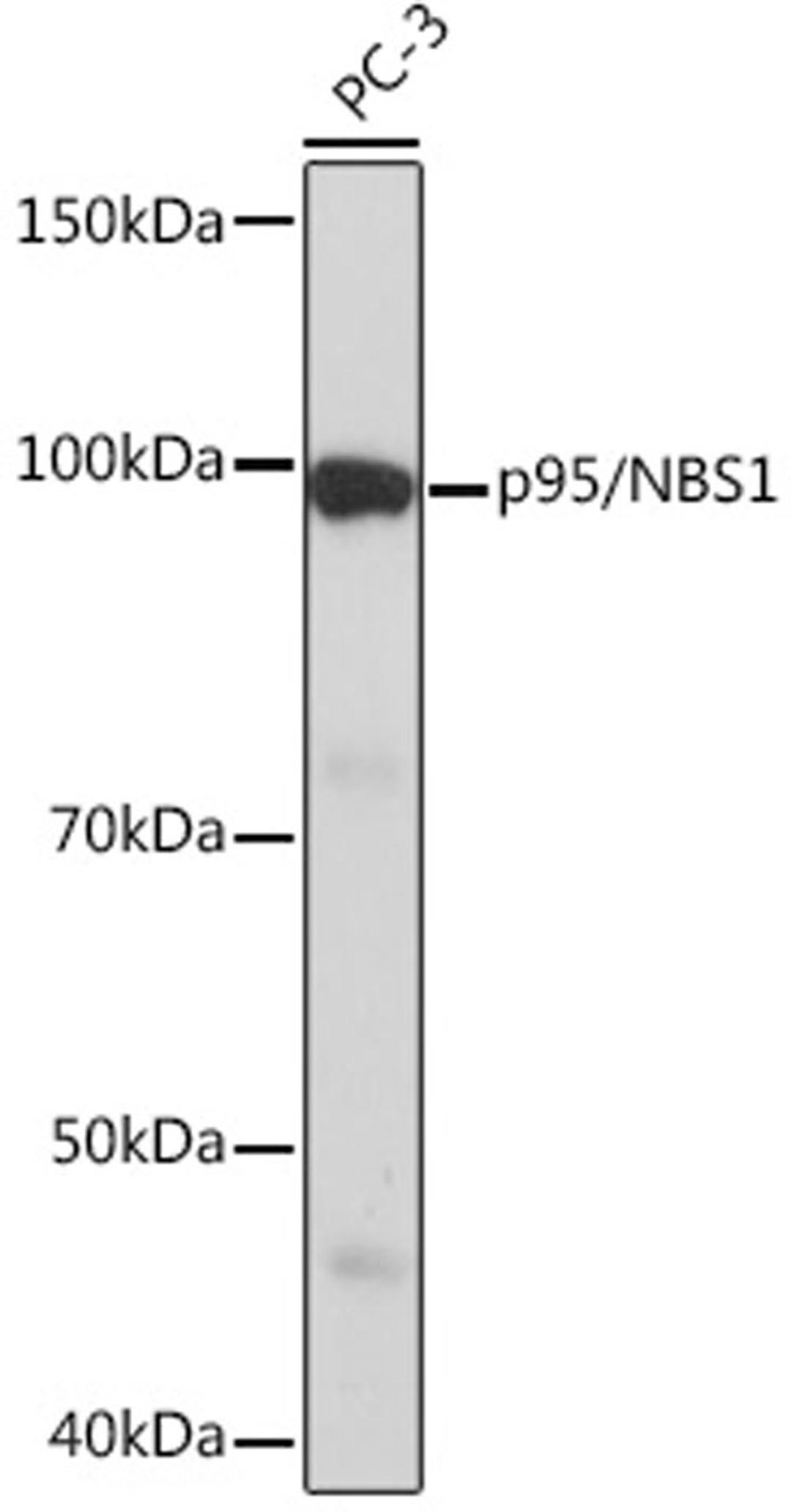 Western blot - p95/NBS1 Rabbit mAb (A4197)