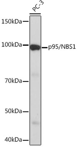 Western blot - p95/NBS1 Rabbit mAb (A4197)