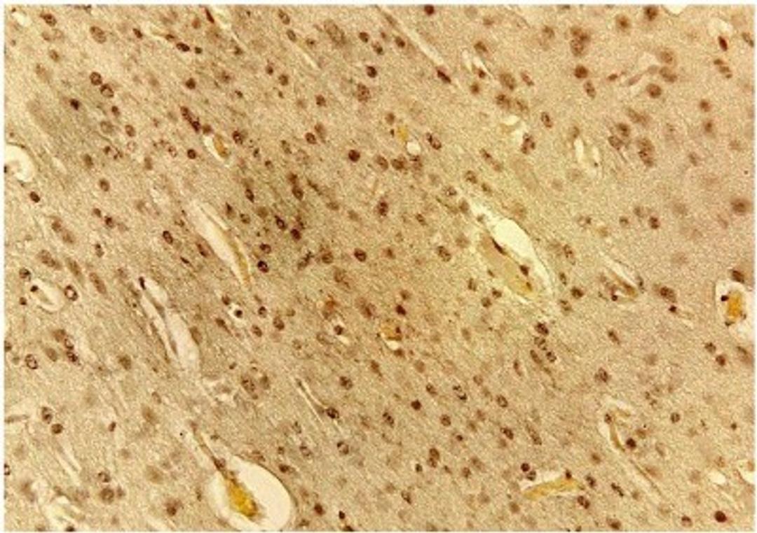 Immunohistochemistry-Paraffin: VEGF Antibody (VG76e) [NB100-648] - IHC analysis of VEGF in fetal sheep brain tissue. Image courtesy of anonymous customer review.