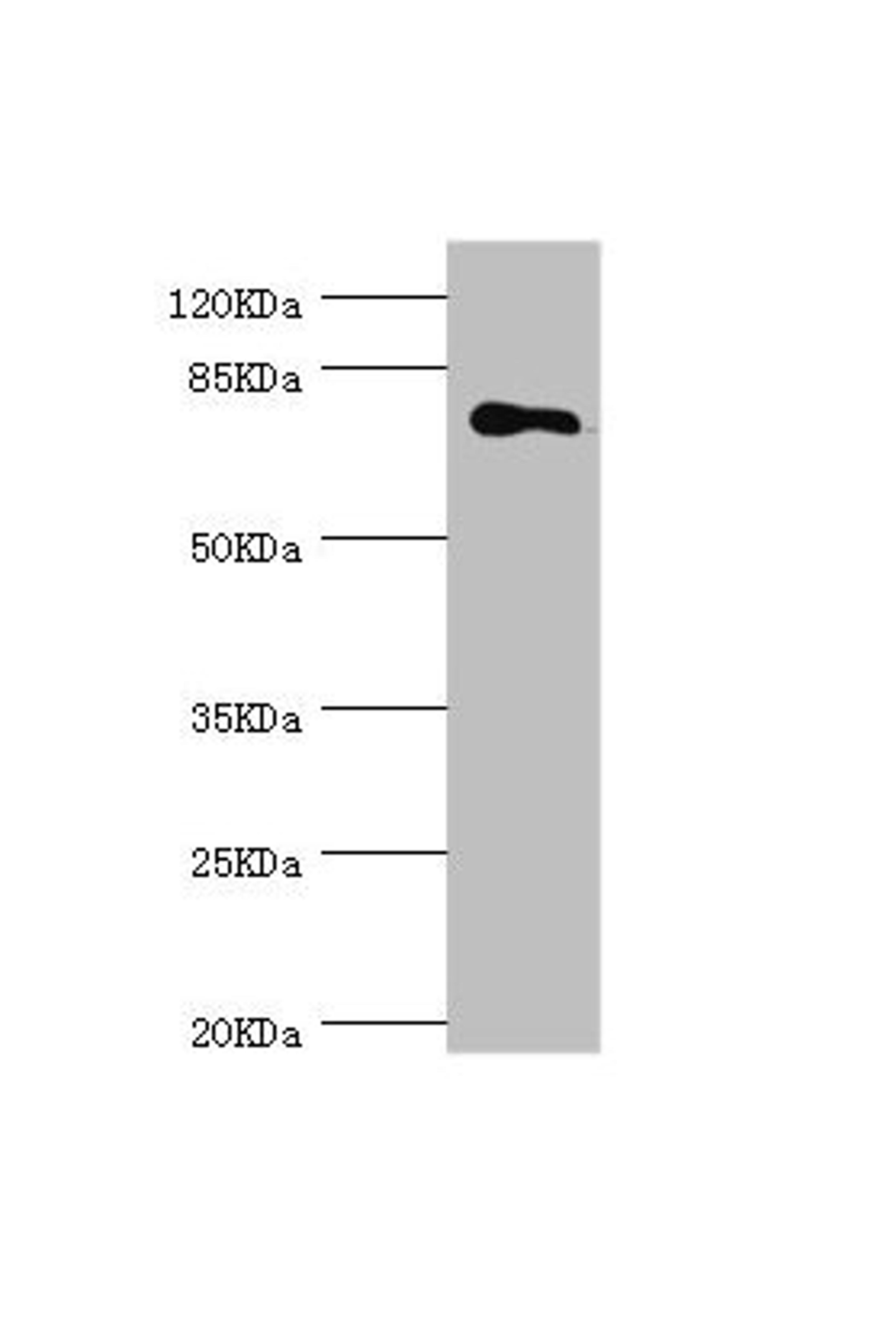 Western blot. All lanes: MGAT1 antibody at 1.18µg/ml + 293T whole cell lysate. Secondary. Goat polyclonal to rabbit IgG at 1/10000 dilution. Predicted band size: 75 kDa. Observed band size: 75 kDa