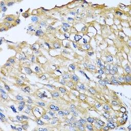 Immunohistochemical staining of human liver tissue using CCL8 antibody (dilution of 1:100)