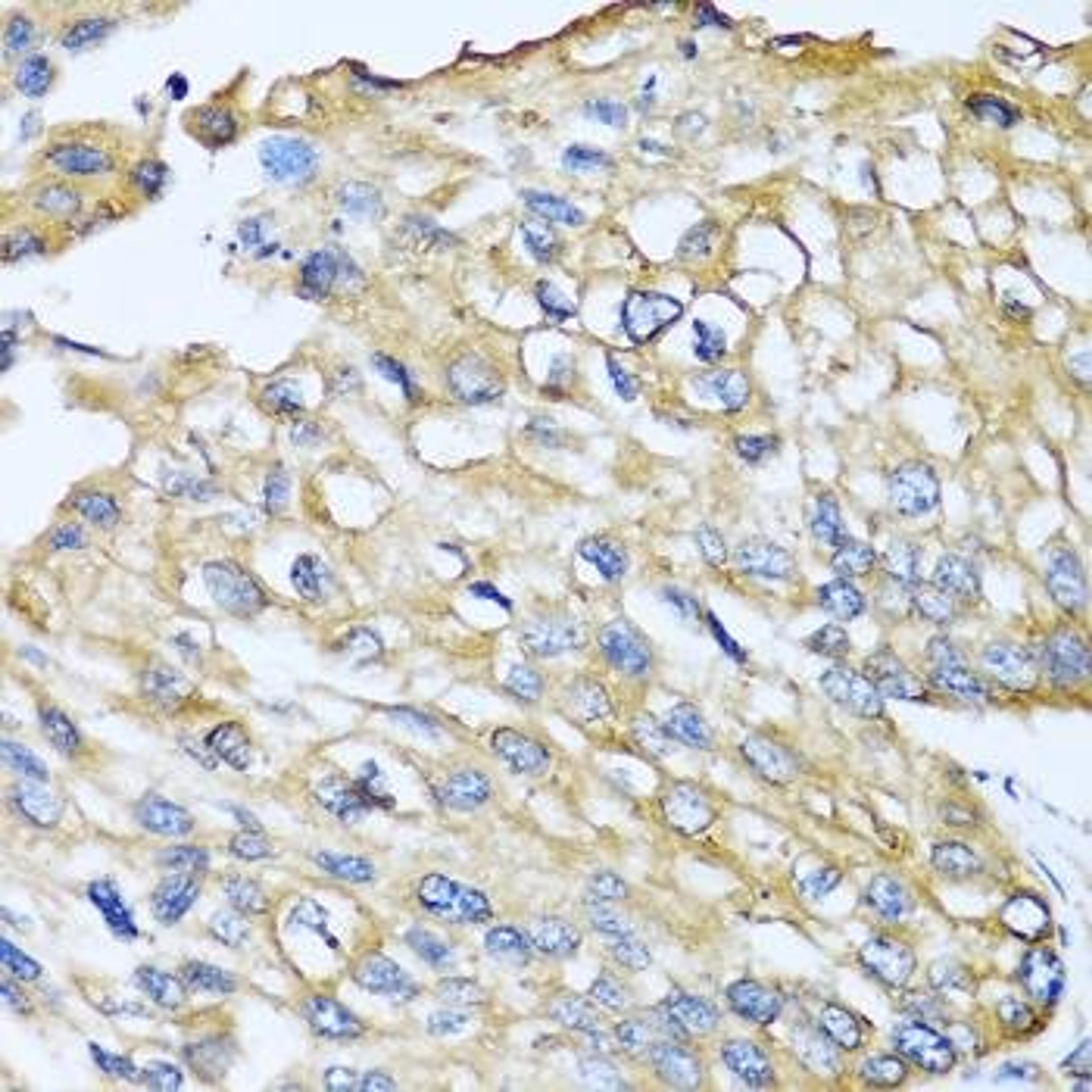 Immunohistochemical staining of human liver tissue using CCL8 antibody (dilution of 1:100)