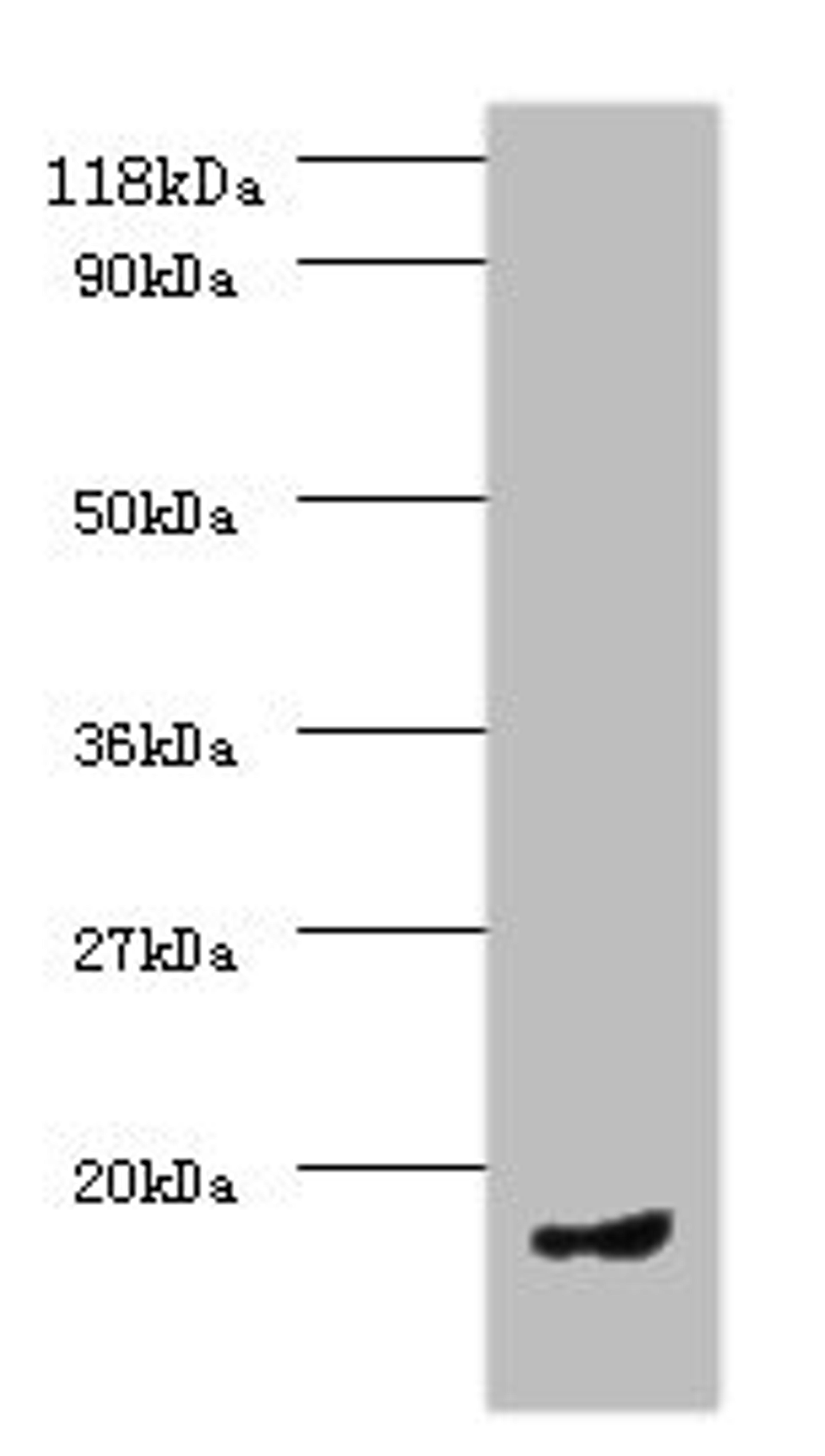 Western blot. All lanes: CCL5 antibody at 2µg/ml + PMBC whole cell lysate. Secondary. Goat polyclonal to rabbit IgG at 1/10000 dilution. Predicted band size: 10 kDa. Observed band size: 10 kDa