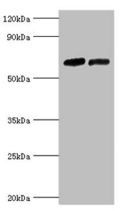 Western blot. All lanes: Nuclear receptor subfamily 2 group C member 1 antibody at 10ug/ml. Lane 1: PC-3 whole cell lysate. Lane 2: 293T whole cell lysate. Secondary. Goat polyclonal to rabbit IgG at 1/10000 dilution. Predicted band size: 68, 52, 54 kDa. Observed band size: 68 kDa. 