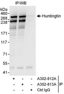 Detection of human Huntingtin by western blot of immunoprecipitates.