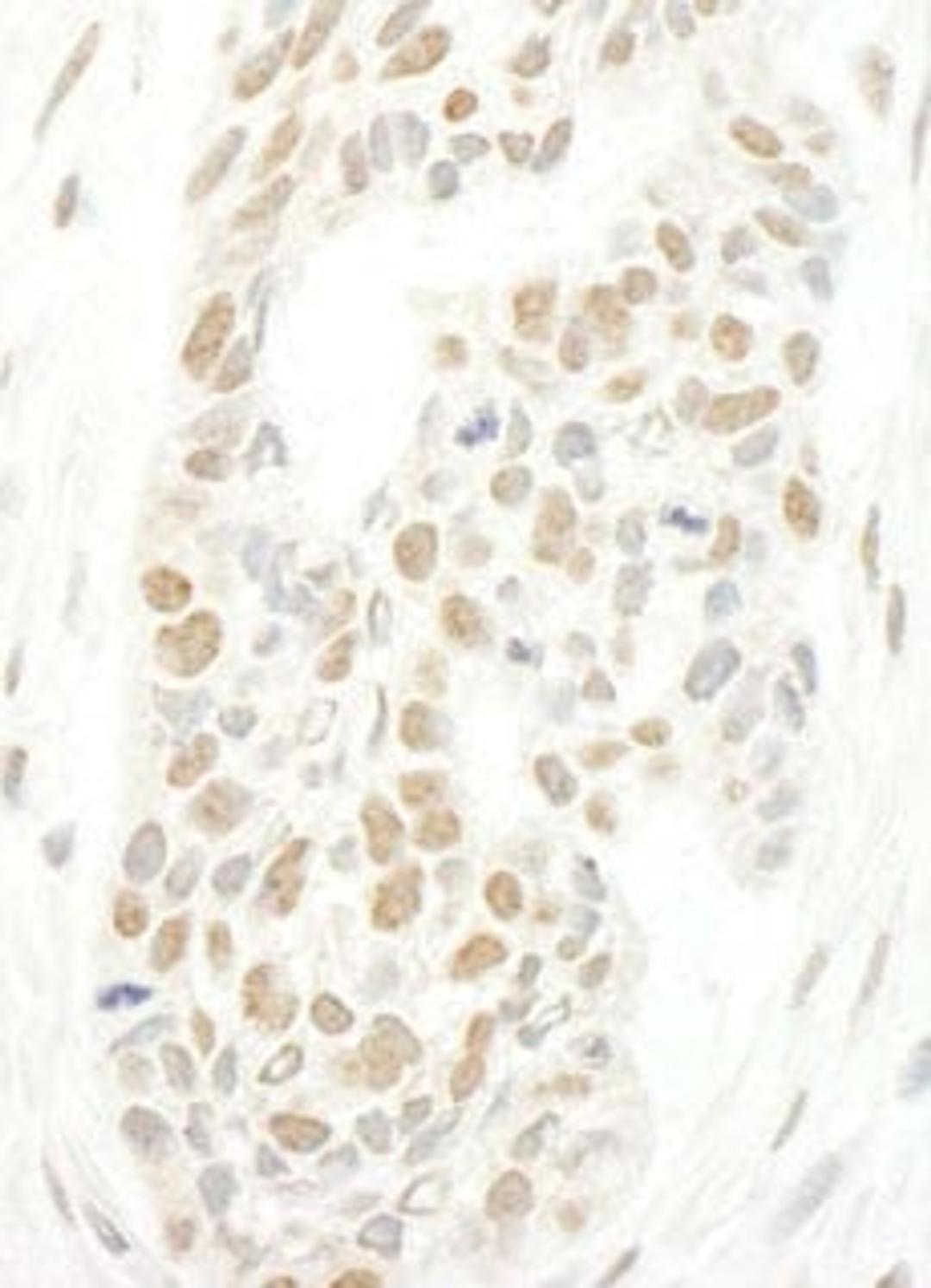 Detection of human CAP-H2 by immunohistochemistry.