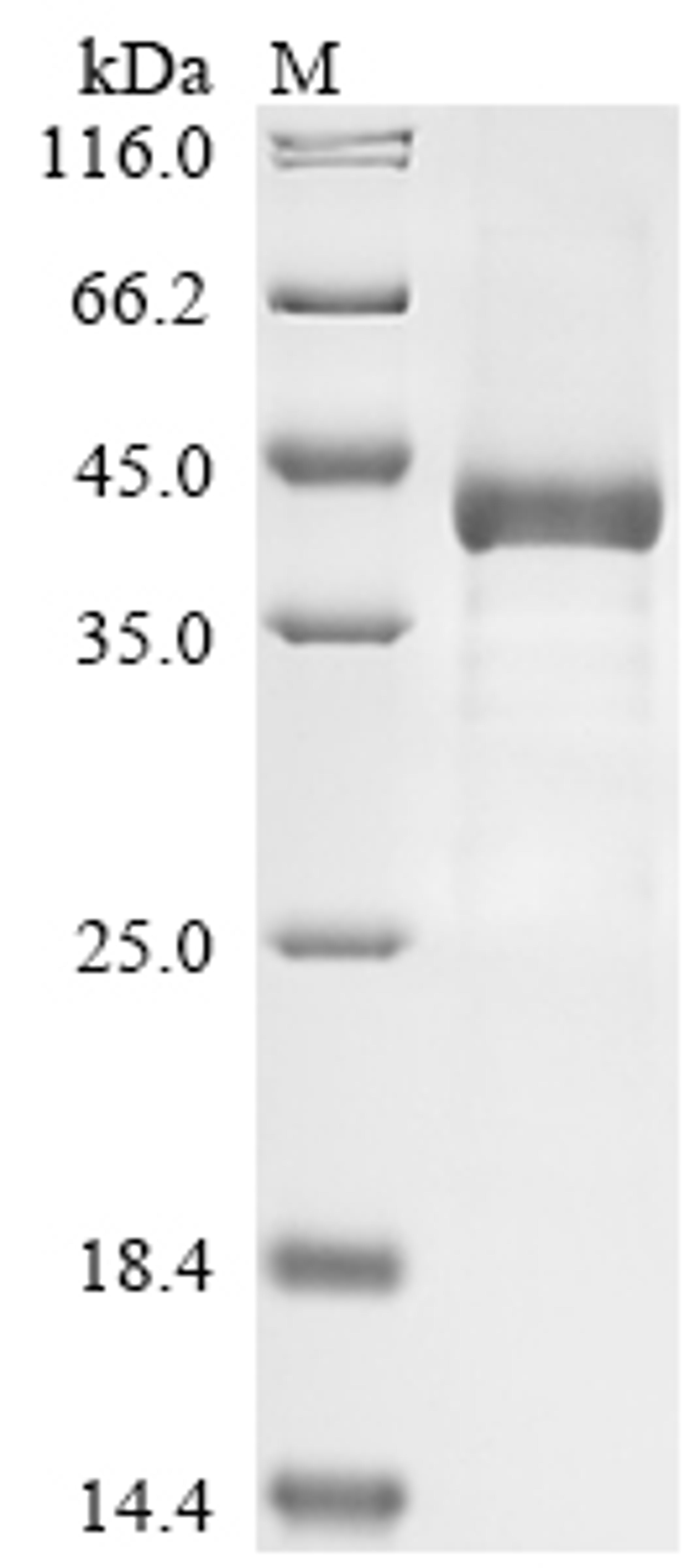 (Tris-Glycine gel) Discontinuous SDS-PAGE (reduced) with 5% enrichment gel and 15% separation gel.