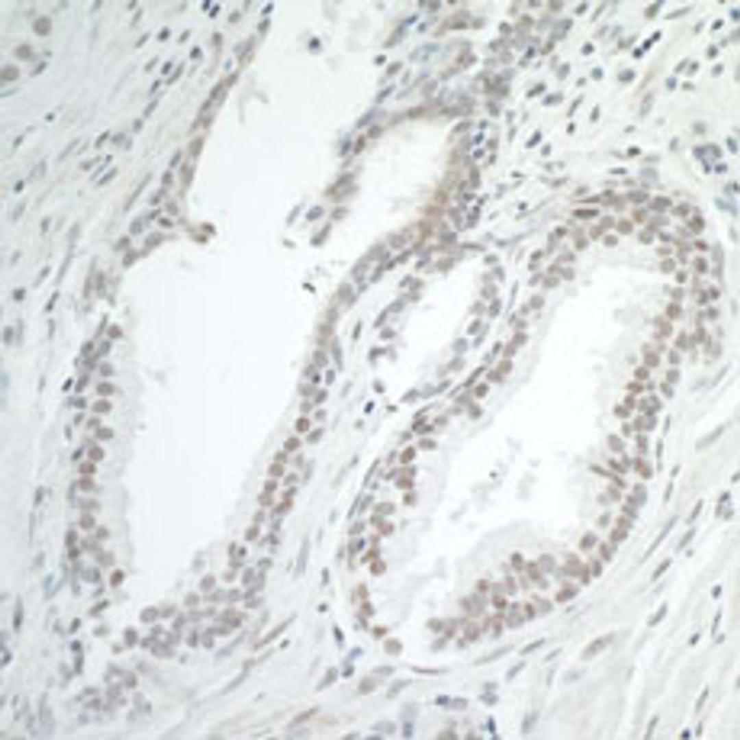 Detection of human BRD7 by immunohistochemistry.