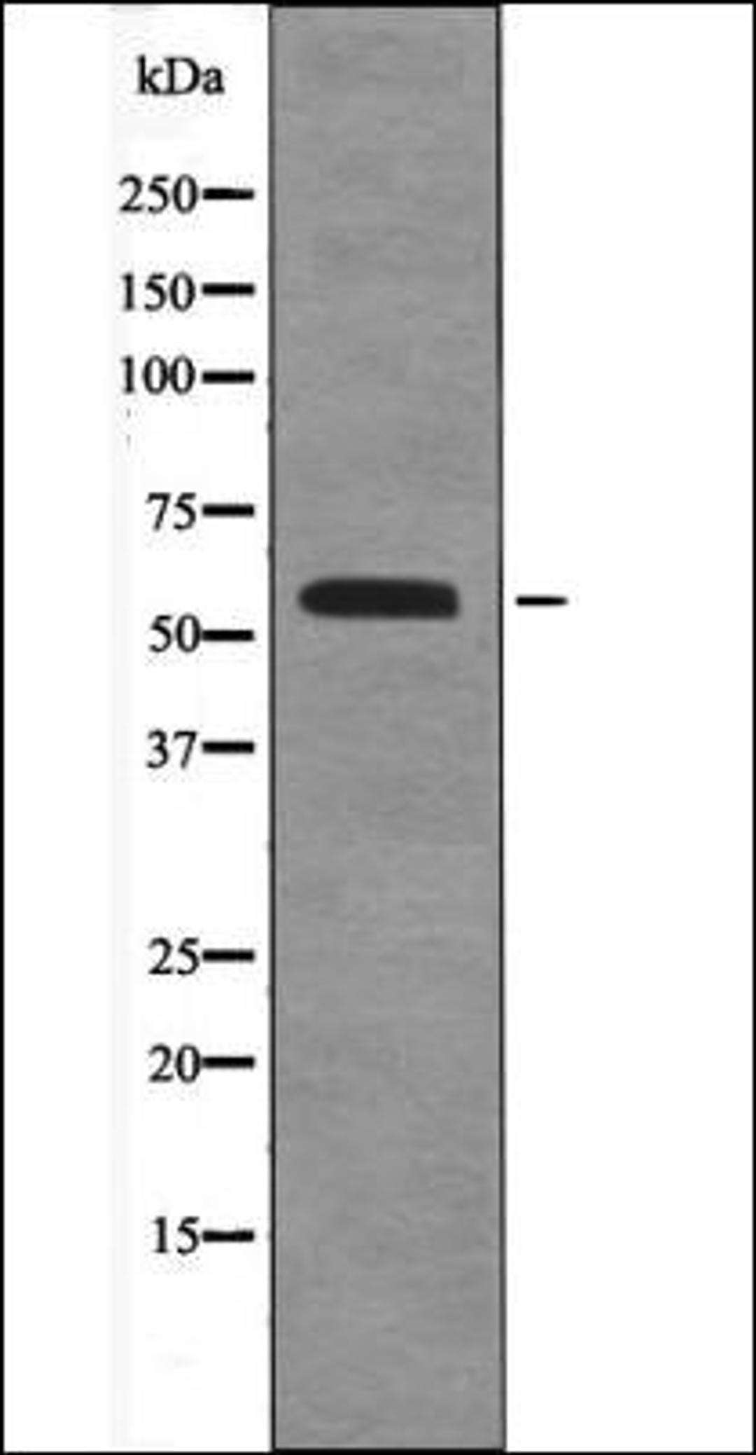 Western blot analysis of COS7 whole cell lysates using BLK -Phospho-Tyr389- antibody