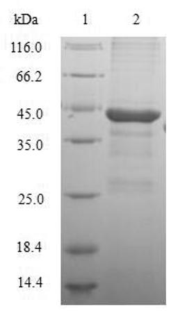 (Tris-Glycine gel) Discontinuous SDS-PAGE (reduced) with 5% enrichment gel and 15% separation gel.