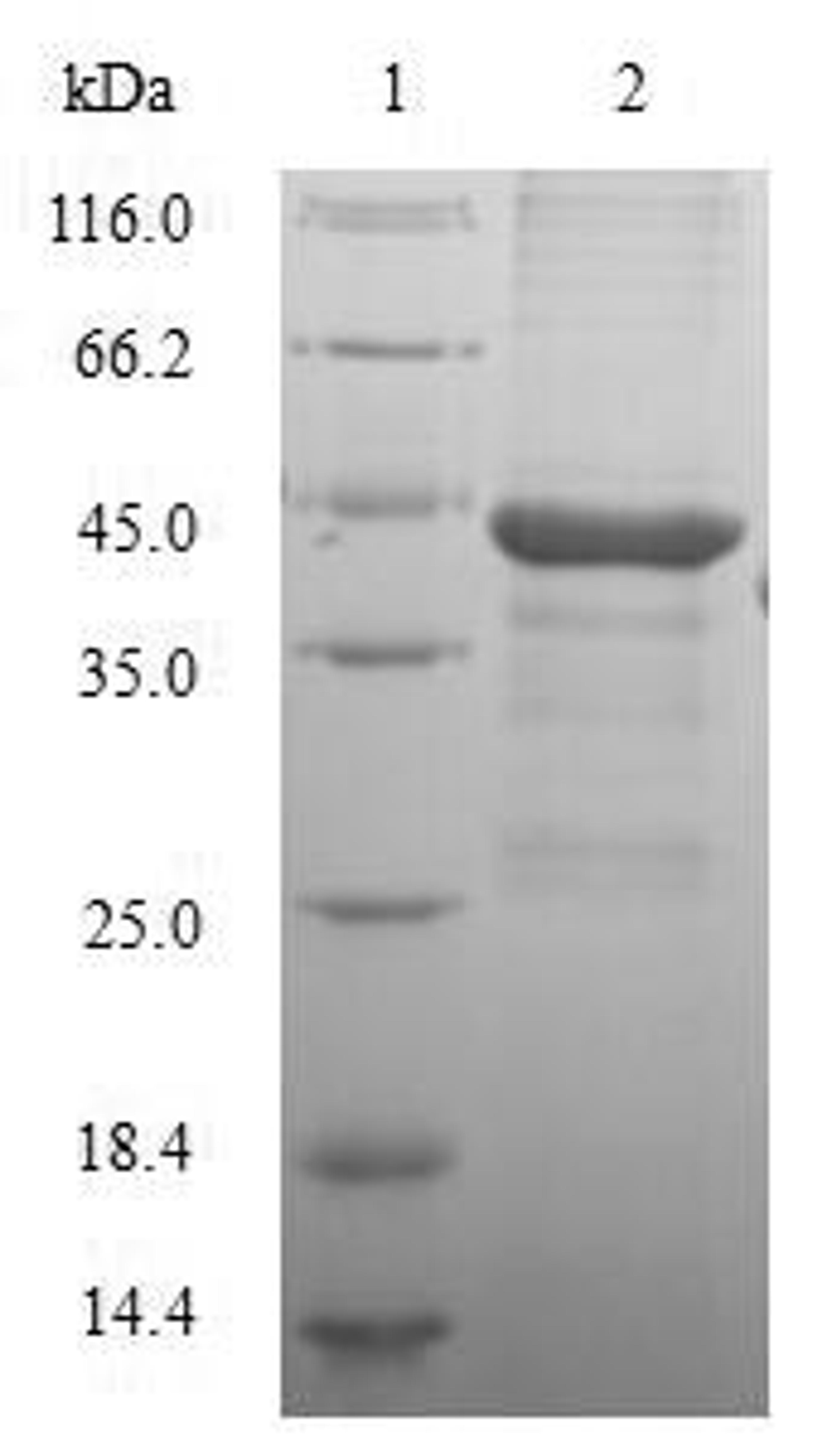 (Tris-Glycine gel) Discontinuous SDS-PAGE (reduced) with 5% enrichment gel and 15% separation gel.
