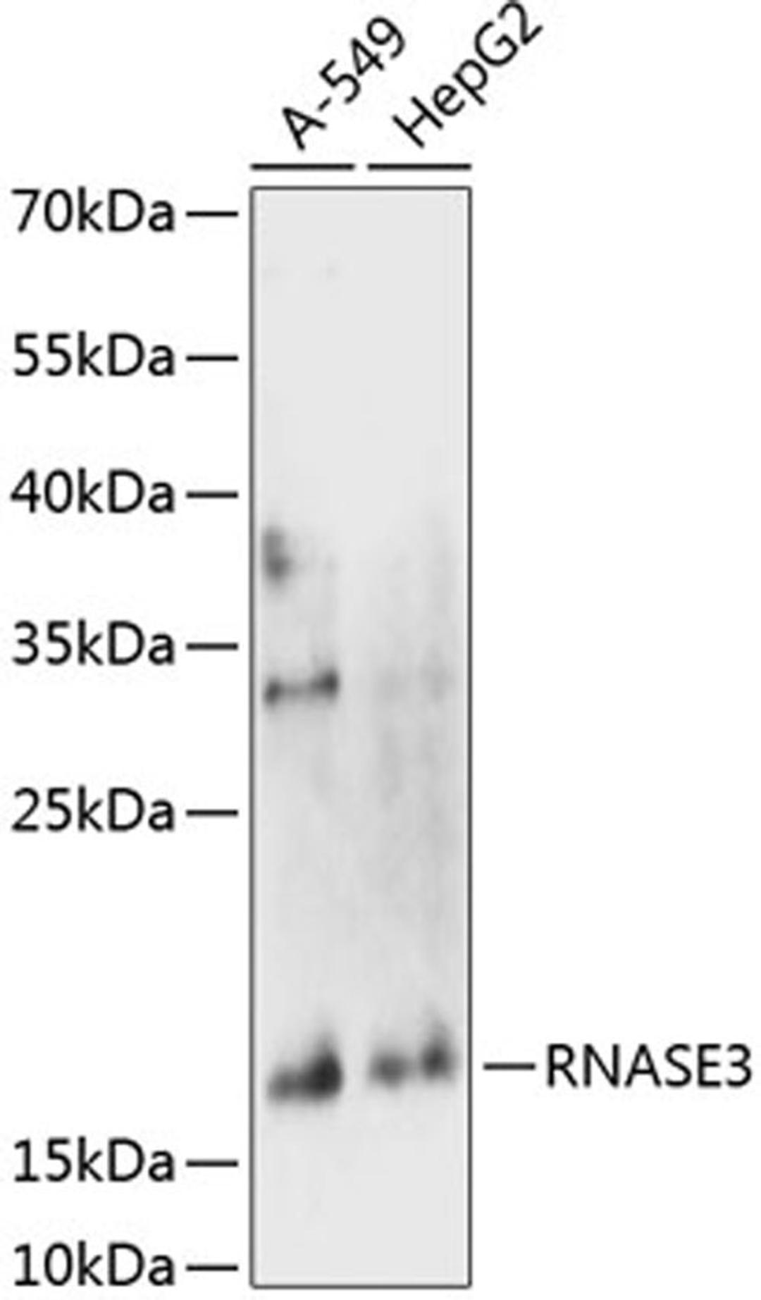 Western blot - RNASE3 antibody (A14489)