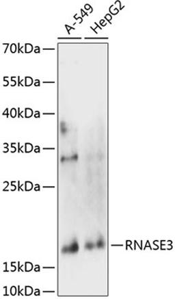 Western blot - RNASE3 antibody (A14489)