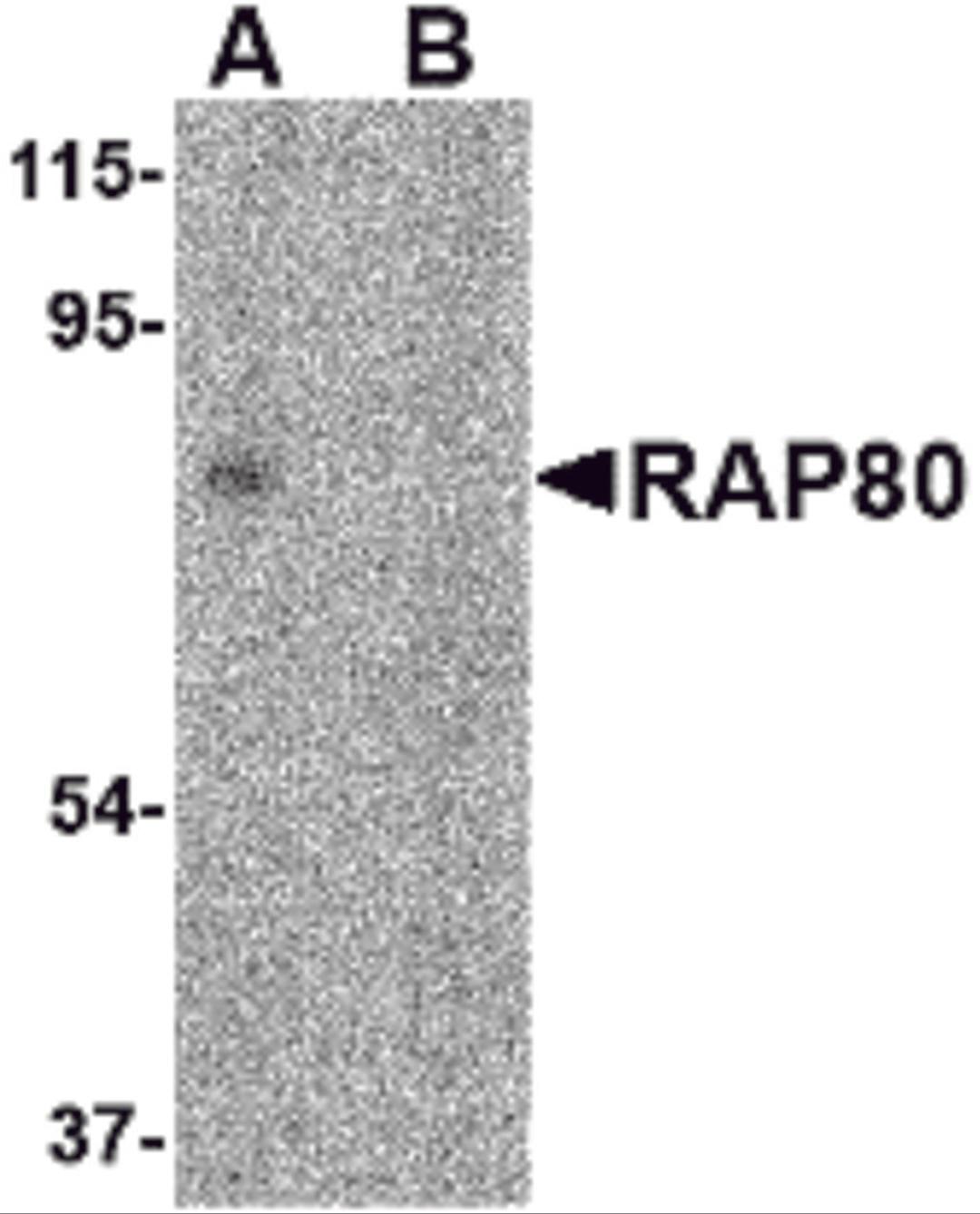 Western blot analysis of RAP80 in 293 cell lysate in (A) the absence and (B) presence of blocking peptide with RAP80 antibody at 2 μg/mL.